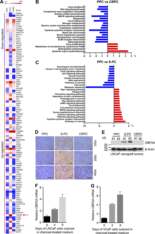 The expression of OBP2A is highly increased in S-PC. Related to Fig. 1. (A) Heatmap of differentially expressed genes in S-PC cells as compared with PPC and CRPC cells. Arrow indicates OBP2A gene. (B and C) KEGG pathway analysis of genes with differentially expressed in PPC vs. CRPC (B) and PPC vs. S-PC (C). The x axis displays the percentage of differentially expressed genes; the y axis indicates name of the pathway in the KEGG database. (D) IHC analysis for OBP2A protein expression in paraffin-embedded tissue sections of PPC, S-PC, and CRPC collected from Myc-CaP allograft mouse (FVB) models. The scale bars represent 50 μm. (E) Western blot analysis of OBP2A protein expression in PPC, S-PC, and CRPC tissues collected from human PCa LNCaP xenograft mouse (Rag1−/−) models. (F and G) Real-time PCR analysis for OBP2A mRNA expression in LNCaP (F) and VCaP (G) cells cultured in charcoal-treated medium at different time points. Error bars represent mean ± SD; n = 3/group. Each panel in D–G is representative of at least two independent experiments. Source data are available for this figure: SourceData FS1.