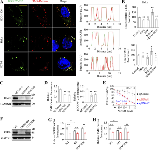 Fatty acid uptake correlates with macropinocytic activity. (A) Co-localization of BODIPY-C16 and TMR-Dextran in HCC1806, HeLa, and HCT-8 cells. Cells were incubated with 5 μM BODIPY-C16 for 30 min prior to 1 mg/ml TMR-Dextran treatment for another 30 min. The right panel shows fluorescence intensity of BODIPY-C16 (green) and TMR-Dextran (red) across lines shown in the left panel. (B) Relative BODIPY-C16 and TMR-Dextran fluorescence in HeLa cells. HeLa cells were pretreated with vehicle, nortriptyline (10 μM), or EIPA (10 μM) for 8 h and then incubated with or without ND-646 (1 μM) and 2 μM BODIPY-C16 or 1 mg/ml TMR-Dextran for 2 h. (C) Western blotting showing CRISPR-Cas9–mediated knockout of RAC1 in MDA-MB-231 cells. (D) Relative BODIPY-C16 and TMR-Dextran fluorescence in MDA-MB-231 RAC1-KO cells. Cells were incubated with BODIPY-C16 (0.5 μM) for 1 h or TMR-Dextran (1 mg/ml) for 2 h. Fluorescence was measured by flow cytometry. (E) Inhibitory effects of ND646 on MDA-MB-231/RAC1-KO cells. (F) Western blotting showing CRISPR-Cas9–mediated knockout of CD36 in MDA-MB-231 cells. (G and H) Uptake of BODIPY-C16 (G) or TMR-Dextran (H) in MDA-MB-231/WT or CD36-KO, or KO cells re-expressing CD36. Cells were incubated with BODIPY-C16 (0.5 μM; G) for 1 h or TMR-Dextran (1 mg/ml; H) for 2 h. Fluorescence was measured by flow cytometry. Images (A) were representative of at least three independent experiments. Data were from quintuple experiments (B) or triplicate experiments (D, E, G, and H), and all experimental data were verified in at least three independent experiments. Error bars indicate the mean ± SD. *, P < 0.05; **, P < 0.01; two-tailed Student’s t test. Scale bar = 10 μm. Source data are available for this figure: SourceData FS4. Refer to the image caption for details.