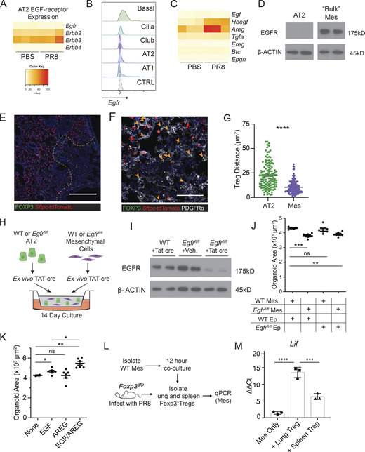 EGFR activation on mesenchymal cells stimulates alveolar growth in vitro. (A) Heatmap of EGFR-family receptor expression by RNA-Seq of FACS-sorted AT2 from PBS-treated and PR8/H1N1-infected mice at dpi 7; n = 4 animals per group. (B) RNA flow cytometry of Egfr expression by epithelial cell type analyzed by RNA PrimeFlow. Control probe = Dapb. (C) Heatmap of EGFR ligand expression determined by RNA sequencing of AT2 from mock-treated (PBS) and PR8/H1N1-infected wildtype animals; n = 4 animals per group. (D) Immunoblot for EGFR protein expression in wildtype mesenchymal and epithelial cells isolated from C57BL/6 mice and cultured overnight prior to protein extraction. Protein input normalized by Bradford assay and validated by staining for β-actin (bottom panels). Representative data from one of two independent experiments shown. (E and F) Immunofluorescence imaging of lung tissue sections from tamoxifen-treated SPCcreER/+Rosa26tdTomato mice infected with PR8/H1N1 influenza at dpi 6. (E) Treg cell (FOXP3+, green) distribution in relation to AT2 (red) or (F) PDGFRα+ mesenchymal cells (Mes, white). Scale bar in E = 400 μm; scale bar in F = 100 μm; filled orange arrowheads indicate Treg cells. (G) Quantification of Treg:AT2 and Treg:Mes distances calculated by K-nearest neighbor analysis. At least four damaged areas were analyzed in each of n = 3 mice. Data represented as mean ± SEM; statistical significance evaluated by two-tailed unpaired Student’s t test (**** P < 0.0001). (H) Alveolar organoid culture setup of lung epithelial and mesenchymal cells isolated from C57BL/6 or Egfrfl/fl mice cultured for 14 d following treatment with TAT-cre to induce Egfr deletion. (I) Immunoblot for deletion of EGFR following in vitro treatment with TAT-cre in Egfrfl/fl lung mesenchymal cells with wildtype mesenchyme and vehicle controls. Protein input normalized by Bradford assay and validated by staining for β-actin (bottom panels). Representative data from one of three independent experiments shown. (J) Quantification of the average area of all organoids ≥1000 µm2 with mesenchymal EGFR deletion, epithelial EGFR deletion, both, or neither (control). Data represented as mean ± SEM. Experiment performed five times (mesenchymal deletion conditions alone: three experiments; epithelial deletion conditions included alongside mesenchymal conditions: two experiments), with normalized data from the latter two experiments represented on graphs. Statistical significance evaluated by one-way ANOVA (** P < 0.01, *** P < 0.001). (K) Organoids generated from co-culture of AT2 and lung mesenchymal cells isolated from C57BL/6 mice grown with or without the addition of rmAREG (100 ng/ml), rmEGF (25 ng/ml), or both, for 14–16 d. Quantification of the average area of all organoids ≥1000 µm2. Data represented as mean ± SEM; statistical significance evaluated by one-way ANOVA (* P < 0.05, ** P < 0.01). Experiment performed three times, with normalized data from all experiments shown. (L and M) In vitro setup of Treg cells co-cultured with isolated lung mesenchymal cells for 12 h at a 1:2 (Treg:Mes) ratio (L) and transcriptional analysis of adherent mesenchymal cells for EGFR activation (M) assessed by qPCR for Lif expression normalized to housekeeping (Tbp). Data represented as mean ± SEM; n = 3 wells/group. Representative data from one of three independent experiments shown; statistical significance evaluated by one-way ANOVA (*** P < 0.001, **** P < 0.0001). Source data are available for this figure: SourceData F4.