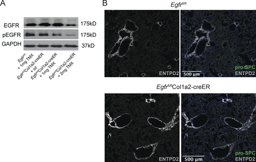 Loss of Egfr on mesenchymal cells phenocopies loss of Treg cell–derived Areg, related toFig. 7. (A) Mesenchymal cells isolated by negative bead enrichment from Egfrfl/flCol1a2-creER mice 3 wk after tamoxifen delivery. Mesenchymal cells plated overnight and prior to stimulation with 25 ng/ml rmEGF. Egfr deletion was confirmed by Western blot of EGFR and phospho-EGFR (pEGFR). Protein input normalized by Bradford assay and validated by immunoblotting for GAPDH or β-actin. Representative data from one of two independent experiments shown. (B) Representative immunostaining of ENTPD2+Col14+ cells (white) and pro-SPC+AT2 (green) in uninfected Egfrfl/flCol1a2-creER and Egfrfl/fl controls 3 wk after tamoxifen treatment. Source data are available for this figure: SourceData FS5. Refer to the image caption for details.