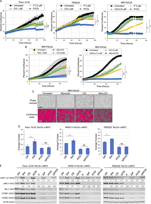 Elevated c-MYC expression does not prevent P/CQ-mediated cell cycle arrest. (A) Panc 10.05, PDX220, and MIA-PaCa2 cells were imaged to assess confluence over time using the IncuCyte Live-Cell Analysis System after treatment with palbociclib (P), CQ, or the combination of both agents (P/CQ). Data represent mean values, and error bars reflect SD of one experiment (n = 3). One-way ANOVA was conducted to determine statistical difference between the single agent controls (CDK4/6 inhibitor or CQ) and the combination group. *, P < 0.05; **, P < 0.01; ***, P < 0.001. (B) MIA-PaCa2 cells were treated with ribociclib (Ribo) or abemaciclib (Abema) alone or in combination with CQ and confluence was measured over time. A one-way ANOVA was utilized to determine statistical significance between the single agent controls and the combination group. The Ribo/CQ experiment was conducted twice (n = 2) and the Abema/CQ experiment was conducted once (n = 3). *, P < 0.05; **, P < 0.01; ***, P < 0.001. (C) Representative images of MIA-PaCa2 cells shown by phase contrast (top) and the corresponding cell mask utilized to estimate well confluence (bottom) for each treatment at 48 h. Bars are 300 μm. (D) Average percentage of cells in S phase for Tet-On c-MYC–expressing Panc 10.05, HPAF-II, and PDX220 cells that were treated for 7 d with DMSO (Ctrl); 2 μg/ml Dox; 5–10 μM CQ and 2.5 μM palbociclib (P/CQ); or D/P/CQ. Control and Dox-treated sample percentages are continued from Fig. 3 B; experiments were performed at the same time as P/CQ- and D/P/CQ-treated samples (n = 3 from two independent experiments, mean ± SEM). *, P < 0.05; **, P < 0.01; ns, not significant by Student’s two-sided t test. (E) Immunoblot analysis of lysates generated from Tet-On c-MYC–expressing cells that were treated for 7 d with DMSO (Ctrl), 2 μg/ml Dox (D), 5–10 μM CQ, 2.5 μM palbociclib (P), or the indicated combinations (representative blots from two independent experiments). Lysates were blotted for c-MYC, pRB (phospho-S807/811), RB, CCNB1, CCNA2, and ACTB. Densitometry quantitation of c-MYC and pRB protein levels normalized to actin are shown. Source data are available for this figure: SourceData F5. Refer to the image caption for details.