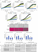 Elevated c-MYC expression does not prevent P/CQ-mediated cell cycle arrest. (A) Panc 10.05, PDX220, and MIA-PaCa2 cells were imaged to assess confluence over time using the IncuCyte Live-Cell Analysis System after treatment with palbociclib (P), CQ, or the combination of both agents (P/CQ). Data represent mean values, and error bars reflect SD of one experiment (n = 3). One-way ANOVA was conducted to determine statistical difference between the single agent controls (CDK4/6 inhibitor or CQ) and the combination group. *, P < 0.05; **, P < 0.01; ***, P < 0.001. (B) MIA-PaCa2 cells were treated with ribociclib (Ribo) or abemaciclib (Abema) alone or in combination with CQ and confluence was measured over time. A one-way ANOVA was utilized to determine statistical significance between the single agent controls and the combination group. The Ribo/CQ experiment was conducted twice (n = 2) and the Abema/CQ experiment was conducted once (n = 3). *, P < 0.05; **, P < 0.01; ***, P < 0.001. (C) Representative images of MIA-PaCa2 cells shown by phase contrast (top) and the corresponding cell mask utilized to estimate well confluence (bottom) for each treatment at 48 h. Bars are 300 μm. (D) Average percentage of cells in S phase for Tet-On c-MYC–expressing Panc 10.05, HPAF-II, and PDX220 cells that were treated for 7 d with DMSO (Ctrl); 2 μg/ml Dox; 5–10 μM CQ and 2.5 μM palbociclib (P/CQ); or D/P/CQ. Control and Dox-treated sample percentages are continued from Fig. 3 B; experiments were performed at the same time as P/CQ- and D/P/CQ-treated samples (n = 3 from two independent experiments, mean ± SEM). *, P < 0.05; **, P < 0.01; ns, not significant by Student’s two-sided t test. (E) Immunoblot analysis of lysates generated from Tet-On c-MYC–expressing cells that were treated for 7 d with DMSO (Ctrl), 2 μg/ml Dox (D), 5–10 μM CQ, 2.5 μM palbociclib (P), or the indicated combinations (representative blots from two independent experiments). Lysates were blotted for c-MYC, pRB (phospho-S807/811), RB, CCNB1, CCNA2, and ACTB. Densitometry quantitation of c-MYC and pRB protein levels normalized to actin are shown. Source data are available for this figure: SourceData F5.