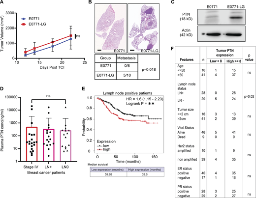 PTN is associated with metastasis in breast cancer. (A) Growth curve of orthotopically implanted (fourth mammary fat pad) E0771 parental (n = 8) and E0771-LG (n = 10) tumors in WT C57BL/6 mice. (B) Representative H&E images of lung metastasis from mice bearing E0771 (n = 8) or E0771-LG tumors (n = 10). Scale bar, 1 mm. Quantification of gross metastasis to lungs in mice bearing E0771 or E0771-LG tumors. Chi-square test; *, P < 0.05. (C) Western blot analysis of PTN expression (18 kD) in E0771 and E0771-LG cell lines, representative of three independent replicates. (D) Bar graph showing plasma levels of PTN in stage IV (n = 67), LN+ (n = 72), and LN− (n = 71) breast cancer patients, as determined by ELISA. Statistical significance was determined using Kruskal–Wallis test. ns > 0.05. (E) Kaplan–Meier plot derived from TCGA database showing overall survival of LN+ breast cancer patients expressing high (n = 220) versus low (n = 232) levels of PTN in their primary tumor. Data were generated from https://kmplot.com/analysis/. Log-rank test; **, P < 0.01. (F) Primary tumor tissues from Fig. 2 F were scored by a pathologist into PTN-high and -low–expressing tumors. Additional patient history was obtained to determine the correlation between PTN expression and clinical pathophysiological features of patients. Chi-square test; *, P < 0.05. Source data are available for this figure: SourceData FS1. Refer to the image caption for details.