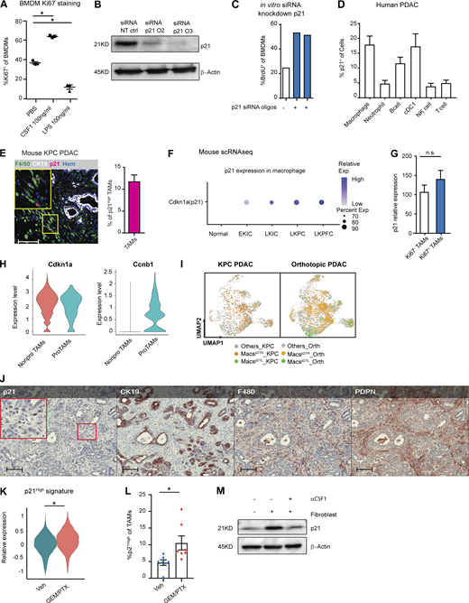 The p21-expressing TAMs have a distinct phenotype, and p21 expression could be induced by chemotherapy. (A) Dot plot displaying the percentage of Ki67+ BMDMs after CSF1 or LPS treatment for 24 h; n = 3/group. (B) Immunoblot showing expression of p21 in BMDMs after treatment with non-targeting siRNA or siRNA targeting for p21 in the presence of CSF1 for 24 h. Experiments were repeated in more than three independent repeats, and included tumor-conditioned medium treatment or were cultured with fibroblasts in the transwell assays. (C) Bar plot displaying quantification of BrdU+ BMDMs in B. The BrdU was pulsed for 20 h. The experiments were repeated three times with three different siRNA oligonucleotides. (D) Bar plot showing percentage of p21+ in different immune populations from human PDAC tumors identified in Fig. S1 A. (E) Representative image of mpIHC for F4/80+ macrophages, CK19+ tumor cells, and p21+ cells with quantification of p21+ macrophages from KPC PDACs; n = 8. (F) Dot plot showing Cdkn1a (p21) gene expressions in the normal pancreas and pancreatic tissues from EKIC, LKIC, LKPC, and LKPFC GEMMs (Hosein et al., 2019). (G) Bar plot showing the expression levels of p21 in Ki67+ and Ki67− TAMs identified in Fig. S1 B; n = 9. (H) Violin plot of the expressions of p21 and Ccnb1 in non-proliferating and proliferating macrophages in the mouse scRNAseq dataset from the KPC, orthotopic KP-2, and normal pancreas in Fig. 1 M. (I) UMAP displaying p21High and p21Low macrophages in KPC PDAC tumors and orthotopic KP-2 tumors. (J) Representative mpIHC images of KPC mouse PDACs displaying p21, CK19, F4/80, and Pdpn staining; n = 8. Scale bars, 100 µm. (K) Violin plot displaying the expressions of p21High signature scores, identified in Fig. 4 M, in TAMs from KPC mice 24 h after GEM/PTX or dimethyl sulfoxide treatment. (L) Bar plot showing percentage of p21High TAMs in KPC GEMM PDAC after DMSO or GEM/PTX treatments. (M) Immunoblot showing expression of p21 in BMDMs in the transwell assay with fibroblast with or without addition of αCSF1 for 24 h. All graphs are expressed as the mean ± SEM. *, P < 0.05. All in vitro assays were consistent across more than two independent repeats. For comparisons between any two groups, Student’s two-tailed t test was used, except for K where the Bonferroni-corrected adjusted P value was used. Source data are available for this figure: SourceData FS2. Refer to the image caption for details.