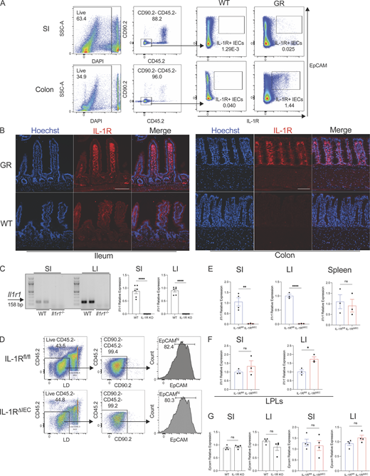 Analysis of IEC expression of IL-1R. (A) Gating strategy after enrichment of IECs from the colon and small intestine (SI) of WT mice. IECs are pregated as Live CD45.2− CD90.2− EpCAMhi cells. EpCAMhi IECs from WT and IL-1RGR/GR mice (GR) which co-express TdTomato (red) were then examined for IL-1R expression by flow cytometry. Representative flow cytometry plots gated on IECs (Live CD45.2− CD90.2−) enriched from the small intestine or colon from WT and GR mice are shown. (B) Histological sections of the ileum and colon of WT or IL-1RGR/GR mice (GR) which co-express TdTomato (red) with IL-1R were counterstained with Hoechst (blue). Scale = 100 μm. (C) PCR and real-time qPCR amplification using Il1r1-specific primers on cDNA isolated from enriched IECs in the small intestine and colon of WT and Il1r1−/− (IL-1R KO) mice. (D) Gating strategy after enrichment of IECs in the colon of IL-1Rfl/fl and IL-1RΔIEC mice. Live CD45.2− CD90.2− EpCAMhi cells are considered to be IECs. (E)Il1r1 expression was measured from IECs in the ileum (left), the colon (middle), or total splenocytes (right). (F)Il1r1 expression was measured from LPLs in the ileum (left) or the colon (right). (G)Epcam expression was measured from IECs in the ileum or the colon of WT and IL-1R KO mice (left) or of IL-1Rfl/fl and IL-1RΔIEC mice (right). Data represent two independent experiments are shown as ± SEM of biological replicates. *P < 0.05, **P < 0.01, and ****P < 0.0001. (C and E–G) Unpaired t test. LI, large intestine. Source data are available for this figure: SourceData FS1.