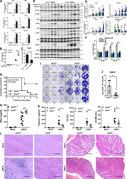 ZNRF1-deficient cells and mice are resistant to EMCV and SARS-CoV-2 infection. (A–D) Wild-type and Znrf1−/− iBMDMs were infected with EMCV (MOI = 10) for 4 h (A and B), 24 h (C), or the times indicated (D). (A) The expression of the indicated mRNAs was analyzed by RT-qPCR. (B) The level of IFN-β in culture supernatant was quantified by ELISA. (C) Plaque assay of EMCV in culture supernatants of infected BMDMs. (D) The levels of phosphorylation of IKKα/β, IRF3, MAPKs, and their unphosphorylated forms were analyzed by immunoblotting. (E and F) Wild-type and ZNRF1−/− Calu-3 cells were infected with SARS-CoV-2 at an MOI of 0.1 and 0.2 for 24 and 48 h. (E) Total RNAs were prepared, and the levels of IFNB, IFNL1, and RANTE mRNAs, as well as SARS-CoV-2 N1 RNA, were quantified by RT-qPCR. (F) Plaque assay of SARS-CoV-2 in culture supernatants of infected Calu-3 cells. (G) Survival of Znrf1+/+ (solid line) and Znrf1−/− (dotted line) mice (n = 9 per genotype) given i.p. injection of EMCV (104 pfu per mouse). (H–K)Znrf1+/+ and Znrf1−/− mice were injected i.p. with EMCV (107 pfu per mouse) for 72 h. (H) ELISA analysis of IFN-β in sera from Znrf1+/+ and Znrf1−/− mice after EMCV challenge. (I) Plaque assay of EMCV in the brain tissues of infected mice (n = 5 per genotype). (J) Quantification of virus titers from I. (K) ELISA analysis of the levels of Troponin-I, CK, and CK-MB in sera from Znrf1+/+ and Znrf1−/− mice upon EMCV infection (n = 9 per genotype). L, liter. (L) H&E staining of histological sections of brain and heart tissues collected from Znrf1+/+ and Znrf1−/− mice 4 d after EMCV infection (104 pfu per mouse) and from mock-infected control mice. Objective magnification, ×20. Scale bar, 200 μm. *P < 0.05, **P < 0.01, and ***P < 0.001 (Student’s t test). Data (except L) are representative of three independent experiments (error bars, mean ± SD). Source data are available for this figure: SourceData F3.