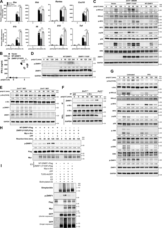 ZNRF1-mediated TLR3 polyubiquitination requires activation by c-Src via phosphorylation at its Y103. (A–C)Znrf1−/− iBMDMs were reconstituted with Tet-inducible vector, wild-type ZNRF1, or ZNRF1(Y103F) mutant, and stimulated with poly(I:C) (30 μg/ml) for the times indicated. (A) The expression of the mRNAs indicated was analyzed by RT-qPCR. (B) The secreted IFN-β in culture media after stimulation with poly(I:C) for 4 h was measured by ELISA analysis. (C) Cell lysates were subjected to immunoblotting with the antibodies indicated. (D)Znrf1−/− RAW264.7 reconstituted with vector, wild-type ZNRF1, or ZNRF1(Y103F) mutant were stimulated with poly(I:C) (30 μg/ml) for the times indicated. Cell lysates were analyzed by immunoblotting. (E)Znrf1+/+ and Znrf1−/− MEFs were stimulated with poly(I:C) (100 μg/ml) for the times indicated and cell lysates were analyzed by immunoblotting. The intensities of the bands are expressed as fold increases compared with those of untreated control cells after normalization to their unphosphorylated forms. (F)Znrf1+/+ or Znrf1−/− BMDMs were stimulated with poly(I:C) (30 μg/ml) for the times indicated. Cell lysates were immunoprecipitated with either IgG or anti–c-Src antibody, and the immunocomplexes and WCL were subjected to immunoblotting with the antibodies indicated. (G) BMDMs from Znrf1+/+ mice were either pretreated with or without PP2 (10 μM) for 1 h, followed by stimulation with poly(I:C) (30 μg/ml) in the absence of PP2 for the times indicated. Cell lysates were collected and analyzed by immunoblotting with the antibodies indicated. (H) HEK293T was transfected with Flag-tagged wild-type ZNRF1, ZNRF1(Y103F), or Myc-tagged c-Src for 24 h. Cell lysates were immunoprecipitated with anti-M2-Flag or anti-Myc antibodies. In vitro kinase assays were performed with immunoprecipitated Flag-tagged wild-type ZNRF1 or ZNRF1(Y103F) and Myc-tagged c-Src with or without λPP as indicated at 30°C for the reaction times indicated, followed by immunoblotting with the antibodies indicated. The intensities of the bands are expressed as fold increases compared with those of untreated control cells, after normalization to their unphosphorylated forms. (I) In vitro ubiquitination assays were carried out with Flag-tagged wild-type ZNRF1 or ZNRF1(Y103F) incubated with Myc–c-Src prepared from H and AcGFP-tagged TLR3 immunopurified from HEK293T cells transfected with AcGFP-TLR3 and recombinant ubiquitin catalytic components as indicated at 37°C for 3 h. The mixtures were then subjected to immunoblotting with the antibodies indicated. *P < 0.05, **P < 0.01, and ***P < 0.001 (Student’s t test). Data are representative of three independent experiments (error bars, mean ± SD). Source data are available for this figure: SourceData F8.