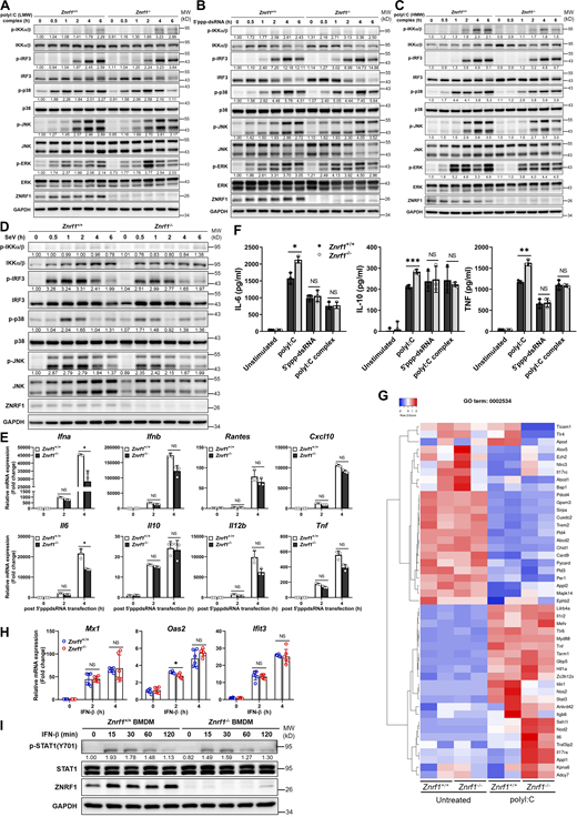 ZNRF1 is not involved in RLR-mediated antiviral signaling or type I IFN–triggered immune responses. (A–E)Znrf1+/+ and Znrf1−/− BMDMs were transfected with poly(I:C) (low molecular weight; LMW; 2.5 μg/ml), poly(I:C) (HMW; 2.5 μg/ml), or 5′ppp-dsRNA (2.5 μg/ml) for the times indicated. (A–C) Immunoblot analysis of p-IKKα/β, p-IRF3, and phosphorylation of MAPKs in cell lysates. (D) Immunoblot analysis of p-IKKα/β, p-IRF3, and phosphorylation of MAPKs in Znrf1+/+ and Znrf1−/− BMDMs, after infection with Sendai virus (SeV; 100 HA units/ml) for the indicated times. The intensities of the bands are expressed as fold increases compared with those of untreated control cells after normalization to their unphosphorylated forms. (E) The mRNA expression of the indicated genes was analyzed by RT-qPCR in Znrf1+/+ and Znrf1−/− BMDMs after transfection of 5′ppp-dsRNA (2.5 μg/ml) for the times indicated. (F) The secretory levels of IL-6, IL-10, and TNF in supernatants of Znrf1+/+ and Znrf1−/− BMDMs stimulated with poly(I:C) (30 μg/ml) or transfected with 5′ppp-dsRNA (2.5 μg/ml) or poly(I:C) (HMW; 2.5 μg/ml) for 16 h were detected by ELISA. (G) Heatmap showing the changes in cytokine production involved in the inflammatory response (GO term: 0002534) in BMDMs from Znrf1+/+ and Znrf1−/− mice after 4 h treatment with poly(I:C) (30 μg/ml). (H and I)Znrf1+/+ and Znrf1−/− BMDMs were stimulated with IFN-β (50 ng/ml) for the times indicated. (H) The mRNA expression of Ifit3, Mx1, and Oas2 was analyzed by RT-qPCR. (I) Phosphorylation of STAT1 and STAT1 in cell lysates was determined by immunoblotting. The intensities of the bands are expressed as fold increases compared to those of untreated control cells, after normalization to their unphosphorylated forms. *P < 0.05, **P < 0.01, and ***P < 0.001 (Student’s t test). Data are representative of three independent experiments (error bars, mean ± SD). Source data are available for this figure: SourceData FS2.