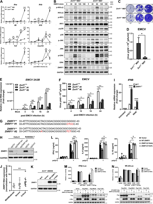 ZNRF1 deficiency in MEFs and BMDMs enhances IFN production and restricts EMCV proliferation after viral infection. (A–D)Znrf1+/+ and Znrf1−/− MEFs were infected with EMCV at MOI of 1 for the times indicated. (A) RT-qPCR analysis of the mRNA expression of the genes indicated. (B) Immunoblot analysis of p-IKKα/β, p-IRF3, and phosphorylation of MAPKs in Znrf1+/+ and Znrf1−/− MEFs. (C) The viral titers in culture media were determined by plaque assays. (D) Quantification of viral particles in C. (E and F)Znrf1+/+ and Znrf1−/− BMDMs were infected with EMCV at an MOI of 5 for the times indicated. (E) RT-qPCR analysis of the expression of EMCV 2A2B RNA in BMDMs. (F) Quantification of viral particles in culture media was made by plaque assays. (G) Sequence analysis of wild-type and two different ZNRF1−/− Calu-3 clones generated by the CRISPR/Cas9 system. Genomic DNA was extracted from wild-type and ZNRF1−/− Calu-3 cells and the region surrounding the targeted site was amplified by PCR for sequencing. Indel mutations are indicated in red. (H) Immunoblot analysis of ZNRF1 protein in cell lysates from scrambled controls (sgCtrl) and ZNRF1−/− Calu-3 and RAW264.7 cells. (I) Calu-3 cells treated with poly(I:C) (30 μg/ml) or R848 (2 μM) for 4 h. RT-qPCR analysis of the expression of IFNB in Calu-3 cells. (J) The RNA level of Znrf1 in patients with mild-to-moderate (n = 10), severe (n = 10), and critical (n = 10) COVID-19 were normalized with healthy controls for clinical validation. Data were analyzed from the National Center for Biotechnology Information GEO database, accession number: GSE167930. (K) Immunoblot analysis of ZNRF1 protein in lysates from Znrf1−/− iBMDMs reconstituted with vector, wild-type ZNRF1, or ZNRF1(C184A) mutant. (L) The secretion of IFN-β, IL-6, and IL-10 into the culture media of Znrf1−/− RAW264.7 cells reconstituted with vector, wild-type ZNRF1, ZNRF1(C184A), or ZNRF1(Y103F) mutants after stimulation with poly(I:C) (30 μg/ml) for 4 h were measured by ELISA. (M and N) HEK293T were co-transfected with IFN-β-Luc (M) or NF-κB-Luc (N) reporter, wild-type ZNRF1 or ZNRF1(C184A) mutant, and the pattern-recognition receptors indicated for 36 h. Cells were harvested, and reporter activities were analyzed by the dual-luciferase reporter assay. The expression of the proteins indicated in cell lysates was confirmed by immunoblotting, as shown in the lower panel. *P < 0.05, **P < 0.01, and ***P < 0.001 (Student’s t test). Data are representative of three independent experiments (error bars, mean ± SD). Source data are available for this figure: SourceData FS3.