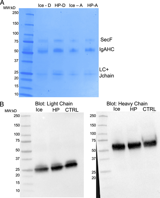 Effect of pasteurization on different antibody components. Two breast milk samples (A and D) were thawed and IgA isolated by passage over a Peptide M column. Each sample was split in two then treated by Holder pasteurization (62.5°C for 30 min) or left on ice for 30 min. Control samples were used just after Peptide M isolation. (A) Samples were boiled in Laemmli buffer and run on an LDS-PAGE gel (4–15% Gradient Acrylamide gel). Samples were normalized to protein content after pasteurization. (B) “D” samples were transferred onto nitrocellulose and blotted for heavy chain (right) or light chain (kappa; left). Samples were normalized to protein content after pasteurization. HP, Holder pasteurization; Ctrl, no treatment; SecF, SeF; IgAHC, IgA heavy chain; LC, light chain; MW, molecular weight. Source data are available for this figure: SourceData FS4 Refer to the image caption for details.