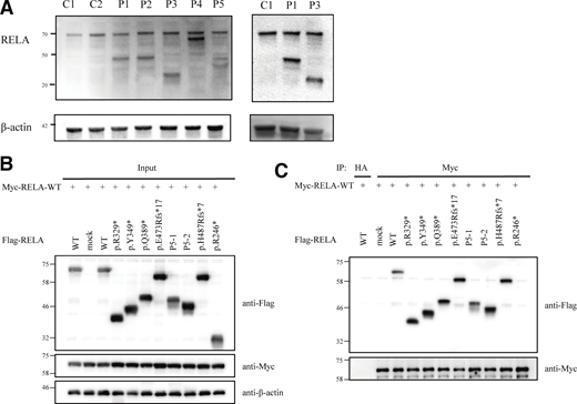 Effect of the pathogenic RELA variants on the expression and dimerization of RelA protein. (A) Immunoblot analysis of RelA protein levels in lymphoblastoid cell line and primary fibroblasts from controls and patients with AD RELA deficiency. The results shown are representative of three independent experiments. Molecular weight units were given in kilodaltons. C1 and C2 mean healthy controls 1 and 2. (B) Immunoblot analysis of RelA protein levels in total protein extracts of HEK293 cells transfected with anti–c-Myc, anti-Flag, or anti–β-actin antibody. (C) Whole-cell lysate immunoprecipitated with anti-HA antibody was used as an experimental negative control. Whole cell lysates were immunoprecipitated with anti–c-Myc antibody and then immunoblotted with anti-Flag or anti-Myc antibody. The p.R246* mutant, which causes RELA haploinsufficiency, impaired binding to WT RelA, whereas the other mutants exhibited normal binding to WT RelA. Two independent experiments were performed to confirm the results. Source data are available for this figure: SourceData F2.