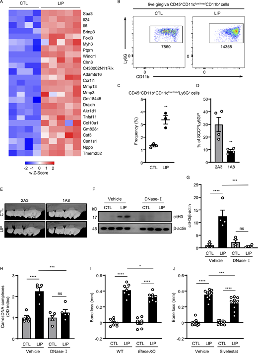 NETs play a pathogenic role in inflammatory bone loss. (A) Mouse gingival tissues of CTL (n = 4) and LIP (n = 5, 5 d) were harvested, and processed for RNA-seq analysis. Heatmap analysis of the RNA-seq data. Significantly differentially expressed genes between CTL and LIP are shown. Each column represents an individual sample. (B and C) Flow cytometry analysis of mouse oral gingival tissues in CTL and LIP (n = 3, 5 d) mice. FACS plot shows changes in neutrophil numbers (B) and graph indicates percentage of CD45+CD11b+ CD11clow/medLy6G+ cells (C). (D) Percentage of neutrophils in gingival tissue after 1A8 (n = 4) or 2A3 (n = 4) treatment. (E) Representative microcomputed tomography images of maxilla from isotype control-treated and anti-Ly6G-treated mice (n = 3). (F–H) Gingival tissues with or without LIP (18 h) in mice treated with DNase-I (n = 4–5) or vehicle (n = 4–5) were harvested, processed, and then subjected to (F and G) immunoblot for citH3 and (H) ELISA for Car–dsDNA complexes. (I and J) Bone loss measurements with or without LIP (6 d) in (I) WT and Elane KO (n = 7–8) mice or (J) mice treated with sivelestat or vehicle (n = 10). Bar graph depicts bone loss. Data are representative of three (C, D, and H) or four (F, G, I, and J) independent experiments. Graphs show the mean ± SEM. * P <0.05, **P < 0.01, ***P < 0.001, ****P < 0.0001. One-way ANOVA with Tukey’s multiple comparison test (G–J), unpaired t test (C and D). Source data are available for this figure: SourceData FS1. Refer to the image caption for details.
