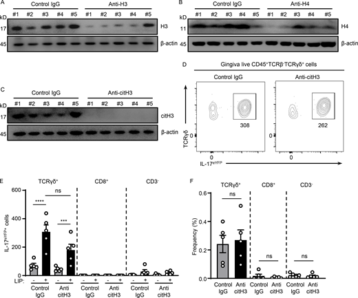 Histones meditate IL-17 cell accumulation in periodontitis. (A–C) Western blot analysis for H3, H4, citH3, and β-actin in mouse oral gingival tissues with or without LIP (6 d) in isotype IgG H3 (n = 5), (A) anti-H3 (n = 5), (B) anti-H4 (n = 5), or (C) anti-citH3 treated mice (n = 5). (D–F) Flow cytometry analysis of mouse oral gingival tissues with or without LIP (4 d) in isotype IgG (n = 5) and anti-citH3 (n = 5) treated IL-17acreR26ReYFP mice. (D) FACS plot and graphs indicating (E) numbers and (F) percentage of γδT+eYFP+, CD8eYFP+, as well as CD3−eYFP+ cells. Data are representative of three (A–C, E, and F) independent experiments. Graphs show the mean ± SEM. ***P < 0.001, ****P < 0.0001. One-way ANOVA with Tukey’s multiple comparison test (E and F). Source data are available for this figure: SourceData FS3.