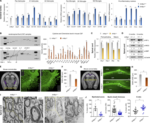 Abnormal myelination is associated with neuroinflammation in an Arl6ip1−/−mouse model of HSP. (A) mRNA levels of glial or pro-inflammatory marker genes in the cortex from Arl6ip1−/− and Arl6ip1+/+ mice at 6 mo. Data represent mean ± SEM of n = 6 mice/group. (B) Determination of relative levels of mouse cytokines and chemokines using a proteome profiler mouse cytokine array kit in mouse CSF samples at 6 mo. Data represent mean ± SD of n = 8 mice/group. (C) mRNA levels of CNS myelin-related genes in the spinal cord from Arl6ip1−/− and Arl6ip1+/+ mice at 6 mo. Data represent mean ± SEM of n = 6 mice/group. (D) Protein levels of NF-L, MOG, and MBP from pooled lysates in the spinal cord of Arl6ip1−/− and Arl6ip1+/+ mice at 2 and 6 mo, as assessed via western blot (n = 3 mice/group). (E) Mouse coronal section image from Allen Adult Mouse Brain Atlas (http://atlas.brain-map.org) showing internal capsule area (left, marked in purple). Representative NF-L fluorescence staining (right, 200×; scale bar: 100 μm) images in the internal capsule of brain tissues from Arl6ip1−/− and Arl6ip1+/+ mice at 6 mo. CTX, cerebral cortex; HIP, hippocampus; STR, striatum; St, stria terminals; IC, internal capsule. (F) Internal capsule width (myelin thickness) was measured using ImageJ v1.57. Data represent mean ± SD of n = 5 mice/group and are analyzed using Student’s t test. (G) Mouse coronal section image from Allen Adult Mouse Brain Atlas showing the corpus callosum area (left, marked in purple). Representative NF-L fluorescence staining images in white matter regions of brain tissues from Arl6ip1−/− and Arl6ip1+/+ mice at 6 mo (right, 200×; scale bar: 100 μm) CTX, cerebral cortex; HIP, hippocampus; CC, corpus callosum; STR, striatum. (H) Quantification of immunofluorescence staining. Data represent mean ± SD of n = 5 mice/group and are analyzed using Student’s t test. (I) Representative TEM images of spinal cord white matter in Arl6ip1−/− and Arl6ip1+/+ mice at 6 mo (n = 4/group, 15,000×; scale bar: 800 nm). (J) Quantitative data of the percentage of myelinated axons, G ratio, and myelin sheath thickness. G ratio = % axon diameter/diameter of the axon with a myelin sheath. Data represent mean ± SD and are calculated in GraphPad Prism 7.0. *P < 0.05; **P < 0.01; ns, not significant. Data represent averages of three independent biological replicates with two technical replicates for each. Source data are available for this figure: SourceData F2. Refer to the image caption for details.