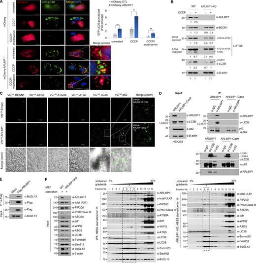 ARL6IP1 regulates mitophagy through interaction with LC3B and BCL2L13 in autophagosome formation. (A) Immunofluorescence detection of LC3B-II puncta in HeLa cells transfected with mCherry-empty vectors or mCherry-ARL6IP1 after 20 μM CCCP and/or 10 μM wortmannin treatment for 6 h (left, 600×; scale bar: 20 μm). Quantification of LC3B-II puncta per cell in HeLa cells stably expressing GFP-LC3B (right). Data presented as mean values of triplicates ± SD (≥10 images assessed per group). **P < 0.01. (B) Protein levels of autophagosome-related genes were analyzed using western blotting in ARL6IP1 WT and KO MEFs at three passages after 10 µM CCCP treatment for 6 h. (C) Live-cell fluorescence image of HeLa cells cotransfected with indicated vectors (400×; scale bar: 50 μm) observed under a fluorescence microscope and magnified in a bright field (600×; scale bar: 20 μm). (D) Interaction of endogenous ARL6IP1, LC3B, and p62 by IP-western blotting in ARL6IP1 KO HEK293T cells via CRISPR/Cas9-mediated gene editing. (E) Interaction of ARL6IP1 and BCL2L13 by IP-western blotting in HEK293T cells. (F)ARL6IP1 KO and WT MEFs were cultured in starvation medium (HBSS) for 1 h. After flotation assay in iodixanol gradients, fractions were detected by western blotting. Asterisks indicate the floatation of omegasome-related proteins from ARL6IP1 KO and WT MEFs. The arrow indicates the position of the ATG9A protein. Data represent averages of three independent biological replicates. Source data are available for this figure: SourceData F4. Refer to the image caption for details.