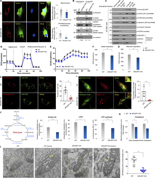 ARL6IP1 deficiency reduces physical and functional coupling of ER–mitochondria. (A) Representative image of immunofluorescence staining of MitoTracker Deep Red and Sec61β in ARL6IP1 KO or WT MEFs at three passages (600×; scale bar: 20 μm). (B) Protein levels of organelle markers in cytoplasmic and crude mitochondria (MT) fraction isolated from ARL6IP1 KO or WT MEFs at three passages. (C) Subcellular fractions were isolated via Percoll density gradient ultracentrifugation from WT MEFs at three passages and analyzed using western blotting. (D and E) Oxygen consumption rate (OCR) and extracellular acidification rate (ECAR) were measured using Seahorse XF24 Extracellular Flux Analyzer in ARL6IP1 WT and KO MEFs at two passages (n = 5/group). (F and G) Quantification of basal and maximal OCR rate using Wave Controller 2.6 (Agilent Seahorse XFe24 Analyzers). Data represent mean ± SD of n = 5/group and two independent experiments. (H) Representative mitophagy image in CCCP-treated ARL6IP1 KO or WT MEFs at three passages using Mitophagy detection kit (left, 600×; scale bar: 20 μm). Quantification of autophagosome/lysosome fusion by puncta numbers in ARL6IP1 KO or WT MEFs (right). Data represent mean values of ≥10 images assessed per experiment ± SD, calculated in GraphPad Prism 7.0. **P < 0.01 (I) Colocalization in fluorescent images by Rhod-2 AM and MitoTracker Green in ARL6IP1 KO or WT MEFs. Rhod-2 AM is used to indicate mitochondrial Ca2+ levels (left, 600×; scale bar: 20 μm). Quantification of immunofluorescence staining. Data represent mean ± SD of ≥10 images/group and are calculated in GraphPad Prism 7.0 (right). (J) Intracellular acetyl-CoA, α-ketoglutarate, and ATP synthesis levels were measured in ARL6IP1 WT and KO MEFs at three passages. Data represent mean ± SD of triplicates per group in three independent experiments. (K) Mitochondrial total and free cholesterol levels were quantified using cholesterol assay kit in ARL6IP1 WT and KO MEFs and represent three independent experiments. Data represent mean values of triplicates ± SD. (L) Representative TEM images of ER–mitochondria tethering in ARL6IP1 KO or WT MEFs. ER–mitochondria contact sites were indicated by arrowheads (left, 52,000×; scale bar: 200 nm; ER, endoplasmic reticulum; Mito, mitochondria; MAM, mitochondria-associated ER membranes). Quantification of ER–mitochondria contact length represents mean ± SD of ≥10 images/group and is calculated in GraphPad Prism 7.0 (right). *P < 0.05; **P < 0.01. Data represent averages of three independent biological replicates. Source data are available for this figure: SourceData F5. Refer to the image caption for details.