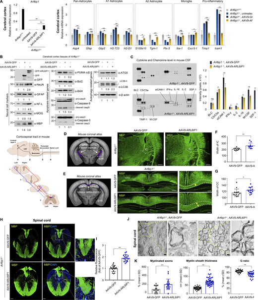 Restoration of CNS remyelination capacity by ARL6IP1 gene transfer. (A) After AAV9 gene delivery, Arl6ip1 mRNA levels were confirmed using RT-qPCR for gene transfer efficiency in the cerebral cortex of Arl6ip1−/− mice. mRNA levels of glial or pro-inflammatory marker genes after AAV9 gene delivery compared with that in Arl6ip1+/+. Data represent mean ± SEM of n = 4 mice/group. (B) Change in protein levels of neural and glial markers (left) and of apoptosis- (middle) or autophagy-related genes (right) from pooled lysates in mouse cortex after AAV9 gene delivery (n = 4 mice/group). (C) Changes in mouse cytokine and chemokine levels in CSF samples after AAV9 gene delivery. A bar graph shows the quantification of cytokine array analysis. Data represent mean ± SD of n = 8 mice/group. (D and E) Mouse coronal section image from Allen Adult Mouse Brain Atlas showing internal capsule and corpus callosum area (left, marked in purple). Representative image of MBP staining of the IC and CC from Arl6ip1−/− after ARL6IP1 gene delivery (40×; scale bar: 500 μm). CTX, cerebral cortex; HIPP, hippocampus, STR, striatum; IC, internal capsule; CC, corpus callosum. (F and G) Quantification of myelin thickness (MBP-positive fibers) in IC and CC region. Data represent mean ± SD of 10 images/group and are calculated in GraphPad Prism 7.0 (n = 5 mice/group; *P < 0.05; **P < 0.01). (H) Representative image of MBP fluorescence staining in the spinal cord from Arl6ip1−/− after AAV9 gene delivery, and highlighted in corticospinal tract of mouse spinal cord (40×; scale bar: 500 μm, 400×, scale bar: 50 μm). (I) Quantification of myelin (MBP staining) of white matter in the spinal cord. Data represent mean ± SD of 10 images/group, calculated in GraphPad Prism 7.0 (n = 5 mice/group; **P < 0.01). (J) Representative TEM images of spinal cord white matter in Arl6ip1−/− after AAV9 gene delivery (n = 3 mice/group, 15,000×; scale bar: 800 nm). (K) Quantitative data of the percentage of myelinated axons, G ratio, and myelin sheath thickness. Data represent mean ± SD of 10 images/group and are calculated in GraphPad Prism 7.0. *P < 0.05; **P < 0.01. Data represent averages of three independent biological replicates with two technical replicates for each. Source data are available for this figure: SourceData F7. Refer to the image caption for details.