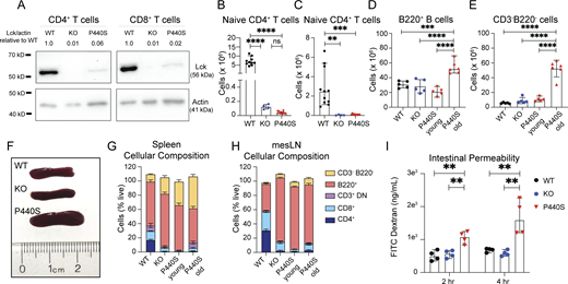 P440S Lck mouse phenotype supplemental data. (A) Lck immunoblot on FACS-sorted splenic CD4+ and CD8+ T cells from mice of the indicated genotypes. (B and C) CD62LhiCD44lo naïve CD4+ T cell counts from spleen (B) and mesLN (C). (D and E) Splenic total counts of B cells (B220+) (D) and non-T/B cells (CD3−B220−) (E) from mice of the indicated genotypes. (F) Image of whole spleens from mice. (G and H) Cellular composition of spleens (G) and mesLN (H) via flow cytometry. (I) FITC-dextran intestinal permeability assay performed on mice. Young P440S mice were 5–6 wk of age. All other mice were 20 wk of age. Experiment in A is representative of results from two independent experiments from pooled mice. Experiments in B and C are representative of results from three independent experiments with 4–11 mice per group. Experiments in D–I are representative of two independent experiments with four to six mice per group. Error bars represent median and 95% CI. **P < 0.01, ***P < 0.001, ****P < 0.0001. Not significant unless stated by asterisk in figure. Ordinary one-way ANOVA with Tukey’s multiple comparisons test was used to test for statistical significance for all experiments. Source data are available for this figure: SourceData FS3.