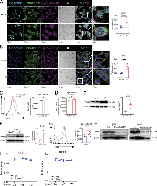 Cell size was changed after IR accompanied by the increase of Piezo2 expression and Ca2+uptake. Related to Fig. 1. (A) The cytoskeleton staining in MC38 cells with or without radiation. Scale bar = 15 µm. (B) The cytoskeleton staining in B16F1 cells with or without radiation. Scale bar = 30 µm. (C and D) MFI of FSC-A tdTomato+ tumor cells from tumors on day 3 (C) and 6 (D) after IR were represented from three independent experiments (n = 4–6 mice per group). (E and F) The assessments of Piezo2 expression in MC38 (E) and B16F1 (F) tumor cells following radiation treatment were represented from three independent experiments. (G) Determination of Ca2+ concentration in tdTomato+ cells from irradiated tumors was shown from two independent experiments (n = 8–9 mice per group). (H) Determinations of Piezo2 expression in MC38 (E) and B16F1 (F) cells with or without gRNA were represented from three independent experiments. (I) Determinations of MC38 (left) and B16F1 (right) cell viability with or without Piezo2 by CCK-8 were shown from two independent experiments. Data were represented as means ± SEM. The comparisons of two nonparametric datasets were calculated by Mann–Whitney U test (A and B). C–G were analyzed by unpaired Student’s t test. *P < 0.05; **P < 0.01; ****P < 0.0001; ns, no significant difference. Source data are available for this figure: SourceData FS1. Refer to the image caption for details.