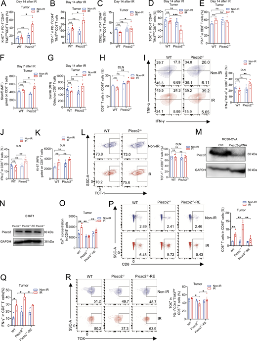 Piezo2 deficiency in tumor cells affected CD8+T cell infiltration and differentiation within irradiated tumors. Related to Fig. 2. (A–D) Quantifications of the percentage of Ki-67+ (A), TCF-1+ (B), CD62L+ (C), and TOX+ (D) in exhausted CD8+ T cells from irradiated tumors on day 14 after IR were shown from two independent experiments (n = 3–9 mice per group). (E) Quantifications of PD-1+ in CD8+ T cells from irradiated tumors on day 14 after IR were shown from two independent experiments (n = 5–6 mice per group). (F and G) Quantifications of expression of Slamf6 on CD8+ T cells from irradiated tumors on day 7 (F) and 14 (G) after IR were shown from two independent experiments (n = 3–8 mice per group). (H–J) The percentage of CD8+ T cell (H), IFN-γ+TNF-α+CD8+ T (I), and IFN-γ+ CD8+ T (J) cells in DLNs from tumor-bearing mice was represented from two independent experiments (n = 4–6 mice per group). (K and L) MFI summary of Ki-67 (K) and the proportion of TCF-1+ (L) in CD8+ T cells in DLNs were shown from two independent experiments (n = 4–7 mice per group). (M) The determination of Piezo2 expression in MC38-OVA cells with or without gRNAs was represented by two independent experiments. (N) The assessment of Piezo2 expression in Piezo2−/− B16F1 with or without mPiezo2-CMV-Sport6 plasmid was shown from two independent experiments. (O and P) Ca2+ concentration measurement in CD45− cells (O) and CD8+ T cell infiltration (P) in CD45+ cells within irradiated WT, Piezo2−/−, and Piezo2−/−-RE tumors were shown from two independent experiments (n = 3–6 mice per group). (Q and R) The percentage of IFN-γ+CD8+ T cells (Q) and TOX+ among exhausted CD8+ T cells (R) from irradiated WT, Piezo2−/−, and Piezo2−/−-RE tumors was represented from two independent experiments (n = 3–6 mice per group). Data were represented as means ± SEM. Statistical analysis was performed by one-way ANOVA with multiple comparison tests. *P < 0.05; **P < 0.01, ns, no significant difference. Source data are available for this figure: SourceData FS2. Refer to the image caption for details.