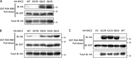 RAC2 Q61R, RAC2 D63V, RAC2 E62K, and RAC2 G12R mutants bind PAK1 RBD. Hemagglutinin-tagged RAC2 (WT) and mutants were expressed for 16 h in HEK293T cells. HA-RAC2 activation level measurements were assessed by GST–PAK–RBD pull-down assay followed by immunoblotting (IB). (A) RAC2 Q61R mutation was compared with WT and the constitutively active mutant RAC2 Q61E. (B) D57N, D63V, and E62K mutations were compared with WT and the constitutively active mutant RAC2 Q61E. (C) RAC2 G12R mutation was compared with WT and the constitutively active mutants RAC2 G12V and RAC2 Q61E. Data are representative for n = 3. Molecular weight (kD) is indicated in the figure. Source data are available for this figure: SourceData F1.