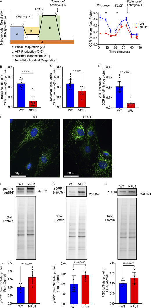 PECs isolated from NFU1G206Crats show impaired mitochondrial function and mitochondrial morphology.(A) The mitochondrial respiration of PECs isolated from 10-wk-old WT and NFU1G206C rats was evaluated by a standard mito-stress Seahorse assay (A, left schematic graph depicturing the curve generated by Seahorse XF Cell Mito Stress Test, and the analyzed parameters of mitochondrial function: basal and maximal respiration, and ATP production. OCR - oxygen consumption rate; right graph represents the original mitostress test profile observed in PAECs isolated from WT and NFU1G206C rats). (B–D) NFU1G206C genotype is associated with a consistently reduced basal (B) and maximal (C) mitochondrial respiration and attenuated ATP production rate (D). (E) To assess the changes in mitochondrial morphology, the isolated PECs were stained with antibodies against the mitochondrial marker mitoNEET located on the outer mitochondrial membrane. (F) The observed fractionation of the mitochondria in NFU1G206C PECs was confirmed by an increased signal from phospo-DRP1 at Ser616, controlling mitochondrial fission. (G) This effect was accompanied by a slight increase in the compensatory phosphorylation of DRP1 at Ser637, which inhibits mitochondrial division. (H) Mitochondrial biogenesis controlled by PGC1α remained unaffected. Panels A–D: N = 9 and 10 for WT and NFU1 groups, correspondingly. Panel E represents at least 100 random fields imaged per each experimental group. Panels F–H: N = 6/group. All panels are representative of two independent experiments. For all panels, the analysis was performed using the Student’s t test, and P < 0.05 was considered significant. Data in A are presented as mean ± SEM. All the rest data are shown as mean ± SD. Source data are available for this figure: SourceData F2.