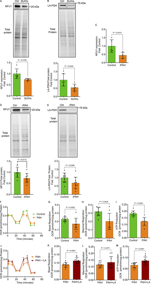 NFU1 deficiency in Su/Hx rat model and iPAH patients and the protective potential of LA supplementation to mitigate MD in patient PAECs. (A–E) The analysis of pulmonary tissues obtained from Su/Hx rats revealed a previously unrecognized decrease in NFU1 protein levels (A) and binding of LA to PDH (B) in this classical PAH model. In addition to animals, the translational aspect of this study was confirmed by revealing a similar insufficiency in the NFU1 expression (C), protein levels (D), and signaling, assessed as PDH lipoylation (E) in the lung samples collected from iPAH patients, the result consistent with the findings observed in NFU1G206C rats (Niihori et al., 2020). (F–I) The mito-stress Seahorse assay revealed an inhibited mitochondrial respiration in PAECs isolated from PAH patients (F) with a significantly attenuated mitochondrial basal (G) and maximal (H) respiration and decreased rate of ATP production (I). (J–M) Notably, acute exposure (12 h) of PAH PAECs to LA was sufficient to significantly improve mitochondrial function in patient PAECs (J) and restore basal (K) but not maximal (L) mitochondrial respiration and increase ATP levels (M), highlighting the critical role of insufficient LA bioavailability in the impaired mitochondrial function observed in PAH patient PAECs. Panels A and B: N = 6/group; panel C: N = 5 in Control and N = 4 in iPAH group; panel D and E: N = 10/group; panels F–H: N = 10 in Control and N = 9 in PAH group; panel I: N = 10 in Control, N = 8 in PAH group; panels J–M: N = 10/group. Representative of one or two independent experiments. Statistical analysis was performed using the Student’s t test, and P < 0.05 was considered significant. Data in F and J are presented as mean ± SEM. For the rest panels, data are presented as mean ± SD. Source data are available for this figure: SourceData F9.