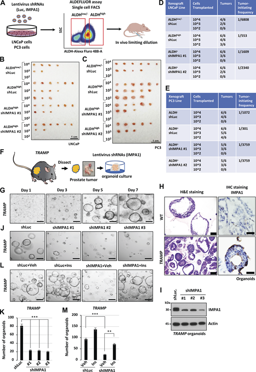 IMPA1-derived inositol is required for maintaining ALDHhighPCSCs and 3D prostate tumor organoids from CRPC TRAMP mouse model. (A) The flow chart shows an experimental outline to demonstrate the tumor-initiating ability of ALDHhigh cells sorted from LNCaP or PC3 cells stably expressing shLuc or shIMPA1 (#1 and #2), followed by transplanting 104, 103, and 102 cells into male nude mice for each group. (B and C) The image of tumor formation from limiting dilution transplantation using LNCaP (B) and PC3 (C) cells. (D and E) Table outlining differences in tumor-initiating frequency of ALDHlow/− or ALDHhigh LNCaP cells (D) and PC3 cells (E) upon limiting dilution transplantation. Tumors arose from transplantation of 104, 103, and 102 ALDHlow/− or ALDHhigh LNCaP cells upon IMPA1 loss. Tumor-initiating frequency was calculated by the ELDA software application for limiting dilution analysis (Hu and Smyth, 2009). (F) The flow chart shows prostate tumor organoids are established from male TRAMP mice, followed by infection with lentivirus shRNAs of IMPA1. (G) Representative images show the growth of prostate tumor organoids from male TRAMP mice at the age of 6 mo with indicated days. Scale bar, 200 μm. (H) H&E staining and IHC staining with IMPA1 antibody of prostate organoids from WT and TRAMP mice at the age of 6 mo. Scale bar, 100 μm for H&E staining; 50 μm for IHC staining. (I) Immunoblotting of tumor organoids from male TRAMP mice with indicated antibodies. Immunoblotting data were verified in at least two independent experiments. (J) Representative images of tumor organoids expressing shLuc or shIMPA1 (#1, #2 and #3) from male TRAMP mice. Scale bar, 200 μm. (K) Quantification of number of tumor organoids from J was shown as the mean ± SEM of three independent experiments for each group. ***, P < 0.001 by two-tailed unpaired t test. (L) Tumor organoids from male TRAMP mice expressing shLuc or shIMPA1 with vehicle (Veh) or 25 μM of inositol (Ins) treatment. Scale bar, 200 μm. (M) Quantification of the number of tumor organoids from L for TRAMP mice was shown as the mean ± SEM of three independent experiments for each group. **, P < 0.01; ***, P < 0.001 by two-tailed unpaired t test. Source data are available for this figure: SourceData F2.