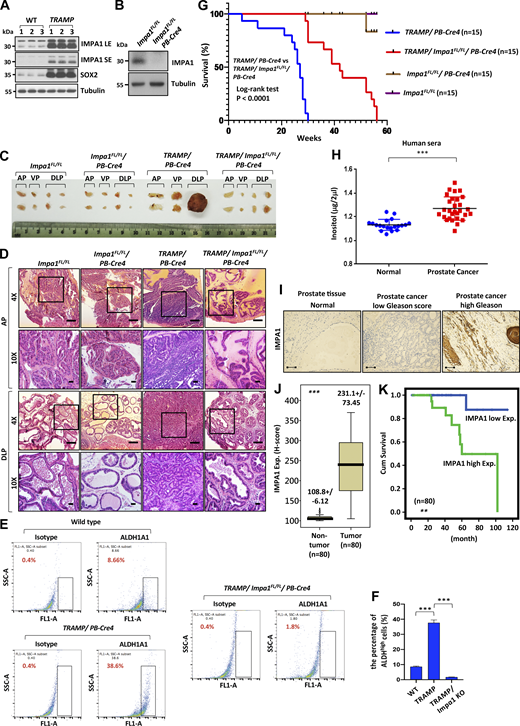 Impa1 deficiency abrogates CRPC progression in TRAMP mouse model and IMPA1/inositol is upregulated in prostate cancer patients and CRPC patients and correlates with poor survival outcome. (A) Immunoblotting of prostate tissue from male C57BL/6J WT (n = 3) and TRAMP (n = 3) mice of 8 mo with indicated antibodies. LE, long exposure; SE, short exposure. Immunoblotting data were verified in at least two independent experiments. (B) Immunoblotting of prostate tissue from Impa1FL/FL and Impa1FL/FL/PB-Cre4 with indicated antibodies. Impa1FL/FL, Impa1FL/FL/PB-Cre4, TRAMP/PB-Cre4, and TRAMP/Impa1FL/FL/PB-Cre4 mice were generated from four generations of backcrossing to maintain in C57BL/6J background. All mice were intercrossed to generate pups, followed by genotyping to group the age-matched mice for each experimental group. Immunoblotting data were verified in at least two independent experiments. (C) Representative images of AP, VP, and DLP lobes of the prostate from Impa1FL/FL, Impa1FL/FL/PB-Cre4, TRAMP/PB-Cre4, and TRAMP/Impa1FL/FL/PB-Cre4 mice at the age of 7 mo. (D) H&E staining of AP and DLP lobes of prostate from Impa1FL/FL, Impa1FL/FL/PB-Cre4, TRAMP/PB-Cre4, and TRAMP/Impa1FL/FL/PB-Cre4 mice at the age of 7 mo with 4× and 10× magnification (three mice for each group). Scale bar for 4× magnification, 500 μm; scale bar for 10× magnification, 100 μm. (E) ALDH1A1 cell population from the prostate tissue of WT, TRAMP/PB-Cre4 or TRAMP/Impa1FL/FL/PB-Cre4 mice was determined by flow cytometry analysis using isotype and ALDH1A1 antibody. (F) The percentage of ALDH1A1 (ALDHhigh) cells from prostate tissue was quantified from E shown as the mean ± SEM of three independent experiments for each group (three mice for each group). TRAMP, TRAMP/PB-Cre4 mice, and TRAMP/Impa1 KO, TRAMP/Impa1FL/FL/PB-Cre4 mice. ***, P < 0.001 by two-tailed unpaired t test. (G) Kaplan–Meier survival plots of Impa1FL/FL, Impa1FL/FL/PB-Cre4, TRAMP/PB-Cre4, and TRAMP/Impa1FL/FL/PB-Cre4 mice (15 mice for each group). P < 0.0001 by log–rank test. (H) The levels of inositol in the sera of normal male people (n = 20) and prostate cancer patients (n = 29) were determined by K-INOSL assay kit. ***, P < 0.001 by two-tailed unpaired t test. (I) IMPA1 protein expression from adjacent normal and prostate cancer patient with low or high Gleason score in our in-house prostate cancer samples was determined by IHC staining. Scale bar, 20 μm. (J) Box plot represents IMPA1 expression in adjacent normal (80 cases) and prostate cancer patients with high Gleason score and advanced stage (80 cases). ***, P < 0.001 by Mann–Whitney U test. (K) Disease-specific survival outcome with IMPA1 low or high expression was shown by Kaplan–Meier plots in prostate cancer patients with high Gleason score and advanced stage (80 cases). **, P = 0.0091 by long–rank test. Source data are available for this figure: SourceData F5.