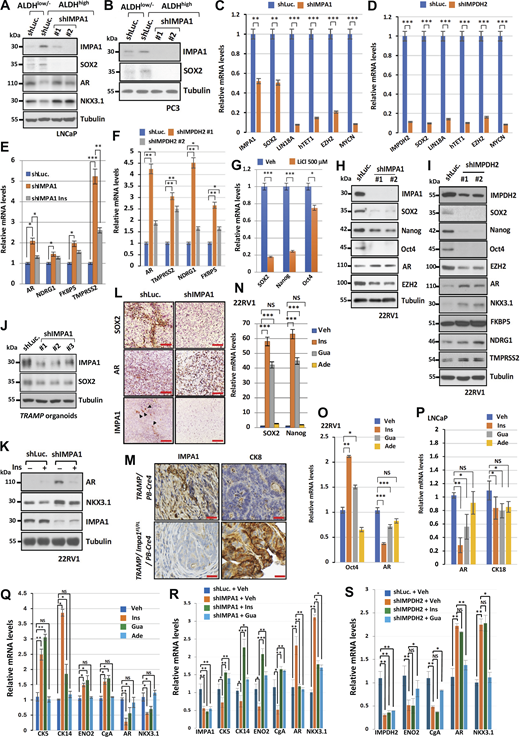 IMPA1/inositol/IMPDH2 maintains PCSCs with ARlow/−features. (A and B) Immunoblotting of ALDHlow/− and ALDHhigh cells sorted from LNCaP (A) and PC3 (B) cells stably expressing shLuc or shIMPA1 (#1 and #2) with indicated antibodies. Immunoblotting data were verified in at least two independent experiments. (C and D) Relative gene expression of reprogramming factors and epigenetic regulators in 22RV1 cells stably expressing shLuc, shIMPA1, or shIMPDH2 were determined by qRT-PCR analysis. Data are shown as the mean ± SEM of three independent experiments for each group. **, P < 0.01; ***, P < 0.001 by two-tailed unpaired t test. (E) Relative gene expression of AR and AR target genes in 22RV1 cells stably expressing shLuc or shIMPA1 upon 40 μM of inositol (Ins) treatment for 48 h were determined by qRT-PCR. Data are shown as the mean ± SEM of three independent experiments for each group. *, P < 0.05; **, P < 0.01; ***, P < 0.001 by two-tailed unpaired t test. (F) Relative gene expression of AR and AR target genes in 22RV1 cells stably expressing shLuc or shIMPDH2 (#1 and #2) were determined by qRT-PCR. Data are shown as the mean ± SEM of three independent experiments for each group. *, P < 0.05; **, P < 0.01 by two-tailed unpaired t test. (G) Relative gene expression of SOX2, Nanog, Oct4 and SYP in 22RV1 cells upon vehicle or 500 μM of LiCl treatment for 48 h were determined by qRT-PCR. Data are shown as the mean ± SEM of three independent experiments for each group. *, P < 0.05; **, P < 0.01; ***, P < 0.001 by two-tailed unpaired t test. (H) Immunoblotting of 22RV1 cells stably expressing shLuc or shIMPA1 (#1 and #2) with indicated antibodies. Immunoblotting data were verified in at least two independent experiments. (I) Immunoblotting of 22RV1 cells stably expressing shLuc or shIMPDH2 (#1 and #2) with indicated antibodies. Immunoblotting data were verified in at least two independent experiments. (J) Immunoblotting of tumor organoid from TRAMP mice expressing shLuc or shIMPA1 (#1, #2, and #3) with indicated antibodies. Immunoblotting data were verified in at least two independent experiments. (K) Immunoblotting of 22RV1 cells expressing shLuc or shIMPA1 upon 25 μM of inositol (Ins) treatment with indicated antibodies. Immunoblotting data were verified in at least two independent experiments. (L) IHC of 22RV1 xenograft tumors stably expressing shLuc or shIMPA1 with indicated antibodies. IHC data were verified in at least two independent experiments. Scale bar, 100 μm. (M) IHC of prostate tissue from TRAMP/PB-Cre4 and TRAMP/Impa1FL/FL/PB-Cre4 mice at the age of 7 mo with indicated antibodies. IHC data were verified in at least two independent experiments. Scale bar, 50 μm. (N and O) Relative gene expression of SOX2, Nanog, Oct4, and AR genes in 22RV1 cells upon the treatment of 40 μM of inositol (Ins), 40 μM of guanosine (Gua), or 40 μM of adenosine (Ade) for 48 h were determined by qRT-PCR. The data are shown as the mean ± SEM of three independent experiments for each group. *, P < 0.05; **, P < 0.01; ***, P < 0.001; NS, non-significant by two-tailed unpaired t test. (P) Relative gene expression of luminal markers in LNCaP cells upon the treatment of 40 μM of inositol (Ins), 40 μM of guanosine (Gua), or 40 μM of adenosine (Ade) for 48 h were determined by qRT-PCR. The data were shown as the mean ± SEM of three independent experiments for each group. *, P < 0.05; **, P < 0.01; NS, non-significant by two-tailed unpaired t test. (Q) Relative gene expression of lineage markers in 22RV1 cells upon the treatment of vehicle (Veh), 40 μM of inositol (Ins), 40 μM of guanosine (Gua), or 40 μM of adenosine (Ade) for 48 h, followed by qRT-PCR. (R) Relative gene expression of lineage markers in 22RV1 cells stably expressing shLuc or shIMPA1 upon the treatment of vehicle (Veh), 40 μM of inositol (Ins), or 40 μM of guanosine (Gua) for 48 h, followed by qRT-PCR. (S) Relative gene expression of lineage markers in 22RV1 cells stably expressing shLuc or shIMPDH2 upon the treatment of vehicle (Veh), 40 μM of inositol (Ins), or 40 μM of guanosine (Gua) for 48 h, followed by qRT-PCR. All data in Q–S are shown as the mean ± SEM of three independent experiments for each group. *, P < 0.05; **, P < 0.01; ***, P < 0.001, NS, non-significant by two-tailed unpaired t test. Source data are available for this figure: SourceData F8. Refer to the image caption for details.