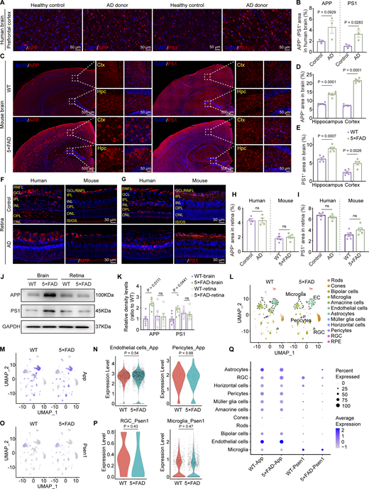 Overexpression of APP and PS1 in the brain but not in the retina. (A, C, F, and G) Representative immunofluorescence images showing the distribution of APP and PS1 in the brain (A and C) and retina (F and G) of AD donors and mice. (B, D, E, H, and I) Quantitative analysis revealed that, compared to healthy controls, the levels of APP and PS1 in the brains of AD patients show an increasing trend (n = 3). When compared to age-matched WT mice, the percentage of APP+ and PS1+ areas in the hippocampus and cortex increased in 5×FAD mice, but there was no significant difference observed in the retina (n = 5). (J and K) Western blot analysis of APP and PS1 protein levels in the brain and retina of WT and 5×FAD mice, with corresponding grayscale values (n = 6). (L) UMAPs showed cell clusters of retinal tissue in 10-mo-old WT and 5×FAD mice based on single-cell sequencing data. (M) UMAP clustering plot showing the distribution and expression levels of App in different cell clusters of retinas from WT and 5×FAD mice. (N) Violin plot showing the gene expression levels of App in retinal endothelial cells and pericytes from WT and 5×FAD mice. (O) UMAP clustering plot showing the distribution and expression levels of Psen1 in different cell clusters of retinas from WT and 5×FAD mice. (P) Violin plot showing the gene expression levels of Psen1 in retinal ganglion cells and macrophages/microglia from WT and 5×FAD mice. (Q) Gene expression dot plots showed the expression of App and Psen1 in the retinas of WT and 5×FAD mice, and the results indicated no significant differences in RNA expression at the cellular level across various cell populations. Data are representative of two independent experiments. Data are presented as mean ± SEM. Statistical analysis was performed using two-tailed unpaired t tests (B, H, I, N, and P) or one-way ANOVA with post hoc Tukey tests (D, E, and K). Source data are available for this figure: SourceData F4.