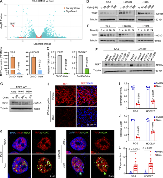 Osimertinib suppresses hTERT expression accompanied by telomerase/telomere inhibition and TIF induction.(A and B) RNA-seq data were generated from PC-9 cells treated with DMSO or 100 nM osimertinib (Osim) for 14 h. Each column is the mean ± SD of triplicate treatments. FPKM, fragments per kilobase per million. (C) RT-qPCR data for hTERT suppression by osimertinib in the indicated cell lines exposed to DMSO or 100 nM osimertinib for 14 h. Each column is the mean ± SD of triplicate treatments. (D–G) The given cell lines were exposed to different concentrations of osimertinib as indicated for 24 h (D), 200 nM osimertinib for varied times as indicated (E), 200 nM indicated EGFR-TKIs for 24 h (F), or 500 nM osimertinib for 24 h (G). The proteins of interest were detected with western blotting. (H) IF was used to detect hTERT in PC-9 tumors treated with 15 mg/kg osimertinib for 9 days. (I and J) The indicated cell lines were exposed to DMSO or 100 nM osimertinib for 24 h and then subject to telomerase (I) and telomere length (J) assays using the Telomerase Activity Quantification qPCR Assay and Absolute Human Telomere Length Quantification qPCR Assay kits, respectively. The data are means ± SDs of four replicate treatments. (K and L) Both PC-9 and HCC827 cell lines were treated with 200 nM osimertinib for 24 h followed with the TIF assay. TIFs were counted from 20 cells for each treatment and represented as means ± SEs. Arrows indicate TIFs (colocalization of TRF2 and γ-H2AX). Statistical differences were assessed with two-sided unpaired Student’s t test. Source data are available for this figure: SourceData F1.