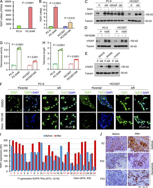 hTERT expression is elevated in EGFRm NSCLC cell lines and patient tumor tissues with acquired resistance to osimertinib.(A) RNA-seq data for hTERT upregulation in osimertinib-resistant PC-9 cells. Each column is the mean ± SD of triplicate treatments. (B) RT-qPCR detection of hTERT mRNA levels in the indicated cell lines. Each column is the mean ± SD of triplicate treatments. (C–E) Western blotting detection of hTERT protein from the indicated cell lines with or without exposure to 200 nM osimertinib (Osim) or HS-10296 for 16 h (C and D) or basal levels of TERT in the indicated cell lines (E). P, parental; AR, AZD9291-resistant; HSR, HS-10296-resistant. (F) IF detection of hTERT in the indicated cell lines exposed to 100 nM osimertinib for 24 h. (G and H) Telomerase activity (G) and telomere length (H) in the tested cell lines were detected using the Telomerase Activity Quantification qPCR Assay and Absolute Human Telomere Length Quantification qPCR Assay kits, respectively. The data are the means ± SDs of four replicate determinations. (I and J) hTERT in human EGFRm NSCLC issues were detected with IHC and representative pictures of hTERT staining are shown (J). WI, weight index, which represents % positive stain × intensity score (0–3). Statistical differences were assessed with a two-sided unpaired Student’s t test. Source data are available for this figure: SourceData F3.