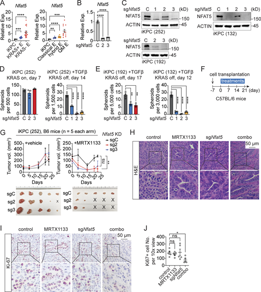 NFAT5 is essential for TGFβ-driven KRAS* bypass. (A)Nfat5 expression in primary KRAS*-expressing PDAC tumors (iKPC), KRAS*-reactivated escaper tumors (KRAS+ E), and KRAS*-independent escaper tumors (KRAS− E) from iKPC mice (left). The same dataset was reanalyzed to indicate Nfat5 expression in different subtypes of escaper tumors from iKPC mice (right), including classical, hybrid, and QM escapers. (B and C) Knockdown efficiency of Nfat5 in iKPC cells assessed by RT-PCR (B) and western blot (C) analysis. (D and E) Cancer spheroid formation assay comparing Nfat5 knockdown to the vehicle control in KRAS*-expressing iKPC PDAC cells and TGFβ-driven KRAS* bypass. Three different iKPC cell lines were used for the study. (F) Experimental design to assess the anti-tumor effect of Nfat5 knockdown in combination with G12Di in vivo. (G) Comparison of tumor growth between the scramble control and Nfat5 knockdown under treatment with G12Di MRTX1133 (10 mg/kg, QD) or vehicle control. Tumors were collected on day 21. (H) Tumor characterization by H&E staining. (I) Characterization of tumors from G by IHC staining. (J) Quantification of Ki67+ cell number per 10× view from I by ImageJ. One-way ANOVA was used for statistical analysis for A, B, D, E, and J; the unpaired, two-tailed t test was used for G at the time point of tumor collection. The P values: ns, not significant; *, P < 0.05; **, P < 0.01, ***, P < 0.001; ****, P < 0.0001. Error bars represent the median ± SEM. All experimental data was verified in at least two independent experiments. Source data are available for this figure: SourceData F6.
