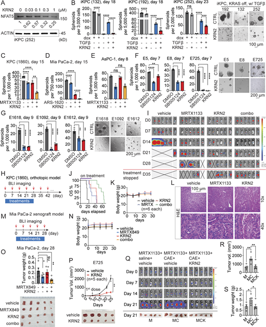 NFAT5 inhibition mitigates KRAS* targeted therapy resistance. (A) Western blot analysis to determine the dose-dependent inhibition of NFAT5 expression by chemical compound KRN2. (B) Comparison of cancer spheroid formation under the treatment of different combinations of dox, TGFβ (0.5 ng/ml), and KRN2 (1 μM) in three distinct iKPC PDAC cell lines. (C) Cancer spheroid formation assay to assess the combination effect of G12Di MRTX1133 (0.03 μM) and KRN2 (1 μM) in KPC PDAC cells. (D) Cancer spheroid formation assay to determine the combination effect of G12Ci ARS-1620 (5 μM) and KRN2 (0.3 μM) in human PDAC MIA PaCa-2 cells. (E) Cancer spheroid formation assay to determine the combination effect of G12Di MRTX1133 (0.3 μM) and KRN2 (0.3 μM) in human PDAC AsPC-1 cells. (F) Comparison of cancer spheroid formation under treatment of DMSO control, TGFβRi SB505124 (3 μM), and KRN2 (1 μM) in three KRAS*-independent escaper tumor cell lines from iKPC mice without CAE treatment. The control E5 images in Fig. 3 L and Fig. 7 F were from the same experiment. (G) Comparison of cancer spheroid formation under treatment of DMSO control, TGFβRi SB505124 (3 μM), and KRN2 (1 μM) in three KRAS*-independent escaper tumor cell lines from CAE-treated iKPC mice. (H) Experimental design to evaluate the anti-tumor effect of KRN2 (3 mg/kg, QD) monotherapy and its combination with G12Di MRTX1133 (10 mg/kg, QD) in vivo. (I) BLI imaging to monitor tumor formation. (J) Kaplan–Meier survival analysis. OS, overall survival. (K) Measurement of mouse body weight along treatments. (L) Tumor characterization by H&E staining. (M) Schematic of the experimental design to assess the combined inhibition of KRAS and NFAT5 in the MIA PaCa-2 orthotopic xenograft model. Tumor-bearing mice were under treatment of vehicle control, G12Ci MRTX849 (100 mg/kg, QD), KRN2 (3 mg/kg, QD), and the combination (combo). (N) Measurement of mouse body weight along treatments. (O) Comparison of tumor weight and size on day 28. (P) Analysis of escaper tumor growth comparing treatment of vehicle control and KRN2 (3 mg/kg, QD). KRAS*-independent escaper tumor cells E725 were transplanted into nude mice subcutaneously. Tumors were collected and imaged on day 28. (Q) Comparison of tumor growth by BLI under treatments: MRTX1133 (10 mg/kg, BID) + saline + vehicle (M), MRTX1133 + CAE (100 μg/kg) + vehicle (MC), and MRTX1133 + CAE + KRN2 (3 mg/kg, QD, MCK). The KPC PDAC cells (1860) were orthotopically transplanted in immunocompetent mice. Tumors were collected on day 21. (R and S) Statistical comparison of tumor volume (R) and tumor weight (S) among the three experimental arms. One-way ANOVA was used for statistical analysis for B–G, R, and S; the unpaired, two-tailed t test was used for O and P at the time point of tumor collection. The P values: ns, not significant; *, P < 0.05; **, P < 0.01, ***, P < 0.001; ****, P < 0.0001. Error bars represent the median ± SEM. All experimental data was verified in at least two independent experiments. Source data are available for this figure: SourceData F7.
