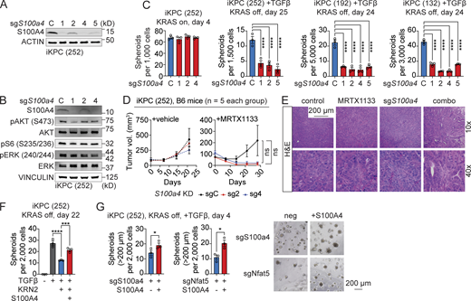 S100A4 is required for KRAS* bypass driven by the TGFβ–NFAT5 axis. (A) Knockdown efficiency of S100A4 in iKPC cells by western blot. (B) Examination of pathway activation after knockdown of S100a4 in iKPC cells by western blot. (C) TGFβ-driven, KRAS*-independent cancer spheroid formation comparison between S100a4 wildtype and knockdown in three distinct iKPC cell lines. (D) Tumor growth analysis of subcutaneously transplanted S100a4 wildtype and knockdown (KD) iKPC cells under treatment of vehicle control or G12Di MRTX1133 (10 mg/kg, QD). (E) Tumor characterization by H&E staining. (F and G) Rescue of TGFβ-driven, KRAS*-independent cancer spheroid formation by S100A4 after NFAT5 inhibition (KRN2, 1 μM) (F) and after knockdown of S100a4 and Nfat5 (G). Statistical analysis for C and F involved one-way ANOVA; the unpaired, two-tailed t test was used for G and for D at the time point of tumor collection. The P values: ns, not significant; *, P < 0.05; **, P < 0.01, ***, P < 0.001; ****, P < 0.0001. Error bars represent the median ± SEM. All experimental data was verified in at least two independent experiments. Source data are available for this figure: SourceData F9.