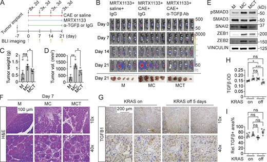 TGFβ pathway activation is required for pancreatitis-induced KRASi resistance. (A) Experimental design for inducing pancreatitis in orthotopically transplanted PDAC models. (B) BLI monitoring tumor formation in comparison groups: MRTX1133 (10 mg/kg, BID) + saline + IgG (M), MRTX1133 + CAE (100 μg/kg) + IgG (MC), and MRTX1133 + CAE + α-TGFβ neutralizing antibody (250 μg per dose, MCT). Collected tumors are shown below. (C and D) Statistical comparison of tumor weight (C) and tumor volume (D) among the three experimental arms. (E) Western blot analysis of canonical TGFβ pathway activation status in PDAC tissues under different treatments. (F) H&E staining of mouse pancreas following various treatments. (G) IHC staining of TGFB1 in KRAS*-expressing tumors and KRAS*-depleted tumors for 5 days from iKPC mice. (H) Quantification of TGFβ signal intensity in G using ImageJ. OD, optical density. (I) Quantification of relative TGFβ-positive area in G using ImageJ. Statistical analysis for C, D, H, and I involved one-way ANOVA. The P values: ns, not significant; *, P < 0.05; **, P < 0.01, ***, P < 0.001; ****, P < 0.0001. Error bars represent the median ± SEM. All experimental data was verified in at least two independent experiments. Source data are available for this figure: SourceData FS1.