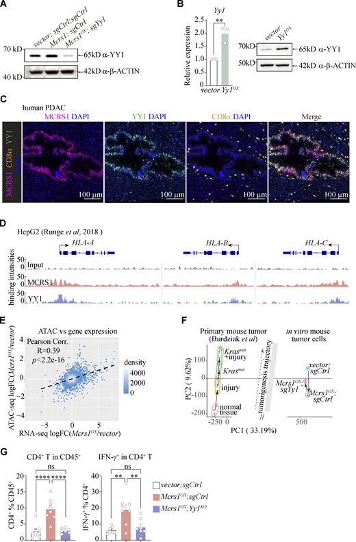 MCRS1 regulates MHC-I through YY1. (A) YY1 protein levels in control, Mcrs1OX, and Mcrs1OX;sgYy1 tumors (N = 2 independent experiments). (B) Overexpression of Yy1 was confirmed at the mRNA and protein levels (n = 3 for both groups in qPCR; presented as means ± SEM; **, P < 0.01; two-tailed unpaired t test; N = 2 independent experiments). (C) Representative images of immunofluorescence staining of DAPI (blue, DNA), MCRS1 (magenta), YY1 (green), and CD8α (orange, T cell) in human PDAC samples. Scale bars = 100 μm. (D) Binding of MCRS1 and YY1 at the human MHC-I loci (HLA-A/B/C) in HepG2 cells. (E) Correlation between the changes of ATAC-seq signals and the changes of gene expression in control and Mcrs1OX cells. FC, fold change. (F) Integrative analysis of ATAC-seq profiles of vector;sgCtrl, Mcrs1OX;sgCtrl, and Mcrs1OX;sgYy1 cells, compared to the tumor development trajectory defined by ATAC-seq profiles of mouse primary pancreatic cancer at different tumorigenesis stages (Burdziak et al., 2023). (G) Total and effector CD4+ T cells in vector;sgCtrl, Mcrs1OX;sgCtrl, and Mcrs1OX;sgYy1 tumors (n = 8, 8, 7; presented as means ± SEM; ns, not significant, P ≥ 0.05; **, P < 0.01; ****, P < 0.0001; one-way ANOVA with Tukey’s multiple comparisons test; N = 3 independent experiments). Source data are available for this figure: SourceData FS5. Refer to the image caption for details.
