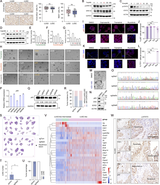 Inhibition of the JAK-STAT pathway blocks the AST process. (A) Representative immunostaining and statistical analyses of 8-oxo-dGuo+ and NQO1+ cells in LUAD and LUSC from EML4-ALK L1196M mice. Scale bar, 50 μm. 40 representative images for each group were counted. (B–D) Western blot analyses of p-ERK1/2 (B), p-STAT3 (C), and p-S6 (D). Club cell–derived EML4-ALK L1196M tumoroids were treated with indicated doses of trametinib (Tra), ruxolitinib (Rux), and capivasertib (Cap) for 12 h and then subjected to western blot analyses. (E–G) Cell viability of club cell–derived LUAD tumoroids treated with indicated doses of trametinib (E), ruxolitinib (F), and capivasertib (G) for 72 h. (H) Representative morphology photos of club cell–derived LUAD tumoroids at early passages (p0/1) treated with indicated doses of capivasertib, trametinib, and ruxolitinib for 4 days. Scale bar, 50 μm. (I) Representative p63 immunofluorescence staining for club cell–derived LUAD tumoroids treated with capivasertib (100 nM), trametinib (10 nM), ruxolitinib (5 μM), or DMSO for six passages. p63 in red; nucleus in blue (DAPI staining). Scale bar, 50 μm. (J) Statistical analysis of p63+ cell ratio per tumoroid. Tumoroids analyzed for DMSO, capivasertib, trametinib, and ruxolitinib groups were 8, 44, 12, and 21, respectively. (K) Representative TTF1 immunofluorescence staining for club cell–derived LUAD tumoroids treated with capivasertib (100 nM), trametinib (10 nM), ruxolitinib (5 μM), or DMSO for six passages. TTF1 in red; nucleus in blue (DAPI staining). Scale bar, 50 μm. (L) Statistical analysis of TTF1+ cell ratio per tumoroid. Tumoroids analyzed for DMSO, capivasertib, trametinib, and ruxolitinib groups were 9, 3, 6, and 6, respectively. (M) Representative morphology photos of club cell–derived LUAD tumoroids treated with 5 μM AZD-1480 for six passages. Scale bar, 50 μm. (N) Western blot analyses of p63, CK5, and SOX2. Club cell–derived EML4-ALK L1196M tumoroids were treated with AZD-1480 (5 μM) or DMSO for six passages and then subjected to western blot analyses. (O) Representative chromogram sequences showing knockout efficiency of sgStat1, sgStat3, sgStat5b, and sgStat6 in club cell–derived plastic EML4-ALK L1196M tumoroids. (P) Relative mRNA levels of p63 in club cell–derived EML4-ALK L1196M plastic tumoroids with or without Stat1, Stat3, Stat5b, or Stat6 knockout. (Q) Protein levels of p63 in club cell–derived plastic EML4-ALK L1196M tumoroids with or without Stat1, Stat3, Stat5b, or Stat6 knockout. (R) Quantification of LUAS/LUSC incidence in the EML4-ALK L1196M model with or without Stat3 knockout. n = 6 for control group (sgTomato, sgTom). n = 5 for sgStat3 group. (S) Representative whole lungs of Stat3 knockout (sgStat3) and control (sgTom) in the EML4-ALK L1196M model. Scale bar, 1 mm. (T) Quantification of LUSC number. (U) Statistical analysis of LUAS and LUSC in the EML4-ALK L1196M model with or without Stat3 knockout. (V) Heat map showing the expression dynamics of multiple STAT3 target genes from TRRUST database (https://www.grnpedia.org/trrust/) in LUAD-like, intermediate, and LUSC-like states (FDR<0.01) according to scRNA-seq data analyses. (W) Representative p-STAT3, TTF1, and p40 immunostaining of the adenomatous components and squamous components within human LUAS samples. Scale bar, 50 μm. Data in A–Q represent one experiment of two independent experiments. Data in R–U were collected from two independent experiments. *P < 0.05, ***P < 0.001 by two-tailed unpaired Student’s t test (A), one-way ANOVA (J and L), one-tailed unpaired Student’s t test (T). ns: not significant. Data are represented as mean ± SEM. Source data are available for this figure: SourceData FS4.