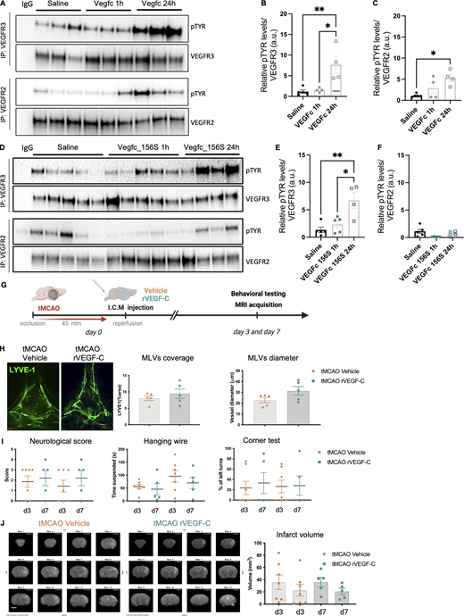 Single-dose VEGF-C treatment does not improve tMCAO outcomes. (A) VEGFR-3 and VEGFR-2 immunoprecipitation (IP) of brain protein extracts followed by western blot detection of phosphorylated tyrosine (pTYR) from mice injected with saline or VEGF-C protein (1 μg) at 1 and 24 h after administration (n = 3/group). (B and C) Quantification of tyrosine phosphorylation levels of VEGFR-3 (B) and VEGFR-2 (C) normalized to immunoprecipitated VEGFR-3 and VEGFR-2 proteins, respectively. *P < 0.05, **P < 0.01. (D) VEGFR-3 and VEGFR-2 IP of brain protein extracts followed by western blot detection of phosphorylated tyrosine from mice injected with either saline or VEGF-C156S protein (1 μg) at 1 and 24 h after administration (n = 5/group). (E and F) Quantification of tyrosine phosphorylation levels of VEGFR-3 (E) and VEGFR-2 (F) normalized to immunoprecipitated VEGFR-3 and VEGFR-2 proteins, respectively. *P < 0.05, **P < 0.01. (G) Experimental setting: mice underwent tMCAO and, after reperfusion, received an ICM injection of either recombinant VEGF-C (VEGF-C156S) or vehicle control (0.25% BSA). (H) Anti-LYVE-1–immunolabeled MLVs in the COS at 7 d-pso, and quantification of MLV coverage and diameter (n = 5 mice/group; Unpaired t test). (I) Neuroscore scale and corner test quantifications at 3 d- and 7 d-pso (n = 7, 5 mice/group; one-way ANOVA test). (J) Representative MRI anatomical T2 weighted scans showing the infarct lesion. Quantification of the lesion volume at 3 d- and 7 d-pso (n = 7–5 mice/group; Kruskal–Wallis test). Scale bar: 170 µm (H). MRI scale bar: 400 µm. Source data are available for this figure: SourceData F9. Refer to the image caption for details.