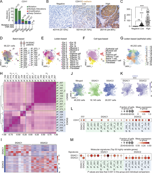 CDH1 inactivation in DGAC patient tumor cells. (A) Genetic alterations of the CDH1 based on the cBioPortal stomach cancer datasets (https://www.cbioportal.org). n represents the total patients number enrolled in each subtype. DGAC, diffuse-type gastric adenocarcinoma; SRCC, signet ring cell carcinoma; TAC, tubular adenocarcinoma; STAD, stomach adenocarcinoma; MAC, mucinous adenocarcinoma; PAC, papillary adenocarcinoma. (B and C) IHC staining of CDH1/E-cadherin in 114 DGAC patient tumor samples. The representative images are shown; scale bar: 50 μm (B). Quantification of H score of CDH1 expression (C). P values were calculated using the one-way ANOVA; error bars: standard deviation (SD). Clinical information of 114 DGAC patients is available in Table S4. (D) Integrated batch-based UMAPs of 19 DGAC patients; integration package: Harmony. Clinical information of 19 DGAC patients is available in Table S5. (E) Integrated Leiden-based UMAP of 19 DGAC patients. Dashed line circle: epithelial cells. Epi: epithelial cells; Myeloid: myeloid cells; Effector T: effector T cells; Naïve T: naïve T cells; Exhausted T: exhausted T cells. (F) Integrated cell type-based UMAP of 19 DGAC patients. All cells were reclustered according to the Leiden clusters and gathered as mega clusters. Dashed line circle: epithelial cells. (G) Epithelial cells were reclustered by Leiden. (H) Correlation matrix plot of epithelial cells showing pair-wise correlations among all samples above. The dendrogram shows the distance of each dataset based on principal component analysis, and the Pearson correlation is displayed with a color spectrum. Groups of patients were categorized by dendrogram and correlation. (I) Type-based heatmap of epithelial cells of integrated datasets in 19 DGAC patients. The top 100 highly variable genes of each type are shown in Table S8. (J) Type-based integrated and separated UMAPs of DGAC1 and DGAC2. (K) Feature plots of epithelial cells displaying CDH1 expression. (L) Dot plots of epithelial cells of CDH1 expression in different DGAC groups and individual patients. P values were calculated by using a t test. (M) Molecular signatures of DGAC1 and DGAC2 patients. Top 50 highly variable genes were used to calculate the molecular signature of each group. Gene list is shown in Table S8. Dot plots of epithelial cells of each molecular signature in different subtypes and individual patient. P values were calculated by Mann–Whitney testing. ns: P > 0.05, ***: P ≤ 0.001. All data are derived from two or more independent experiments with the indicated number of human donors.