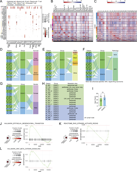 Transcriptional, clinical, and molecular characterization of DGAC subtypes. (A) Dot plots of epithelial cell, myeloid cell, B cell, plasma cell, T cell, effector T cell, naïve T cell, exhausted T cell, fibroblast, and endothelial cell markers in integrated 19 DGAC patients scRNA-seq data. (B) Leiden-based heatmap of all cells of integrated datasets with annotations in 19 DGAC patients. The most highly variable 100 genes of each cluster are shown in Table S6. (C) Leiden-based heatmap of epithelial cells of integrated datasets in 19 DGAC patients. The most highly variable 100 genes of each cluster were showed in Table S7. (D–G) Venn diagram illustrating 19 DGAC patient groups with survival, race, pathology, and gender data. Long-term survivors (surviving over 1 year after diagnosis) and short-term survivors (deceased within 6 mo post-diagnosis) were classified according to our previous publication (Wang et al., 2021). (H) Metastatic sites of DGAC1 and DGAC2 patients. (I) Age difference between DGAC1 and DGAC2 patients. P values were calculated using Student’s t test; error bars: SD. (J–L) Dot plots and GSEA of EMT (J), RHOA (K), and WNT (L) scores in two DGAC types. The datasets we used for dot plots and GSEA are from GSEA molecular signature database (https://www.gsea-msigdb.org/gsea/msigdb/index.jsp): EMT: Human Gene Set: HALLMARK_EPITHELIAL_MESENCHYMAL_TRANSITION; RHOA: Human Gene Set: REACTOME_RHO_GTPASES_ACTIVATE_ROCKS; WNT: Human Gene Set: HALLMARK_WNT_BETA_CATENIN_SIGNALING. P values were calculated by Mann–Whitney testing (J–L). The genes included in each score are listed in Table S9. ns: P > 0.05; ***: P ≤ 0.001. All data are derived from two or more independent experiments with the indicated number of human donors. Refer to the image caption for details.