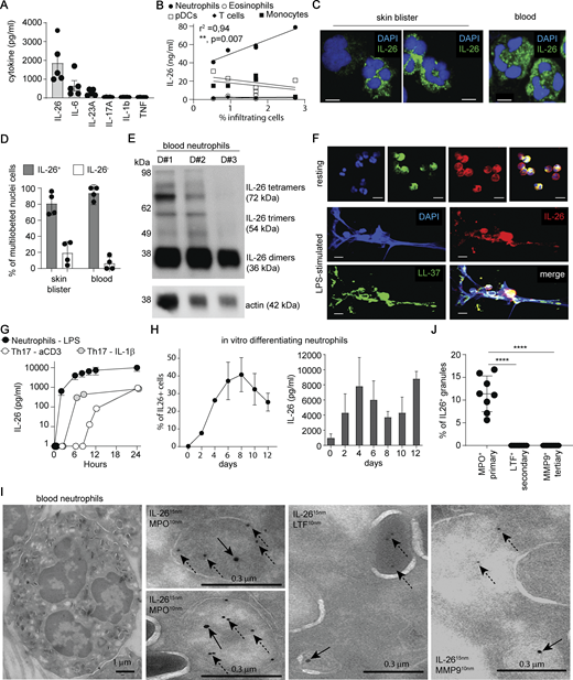 Neutrophils constitutively express IL-26 and store it in primary granules. (A) Levels of IL-26, IL-6, IL-23A, IL-17A, IL-1β, and TNF in blister fluids of five healthy donors. Data are shown as mean ± SEM. (B) Correlation between the levels of IL-26 and the frequency of neutrophils, eosinophils, monocytes, pDCs, and T cells in the blister fluids. Pearson correlation coefficient and two-tailed statistical significance are indicated. (C) Confocal images of cytospinned cells from blister fluids (left and middle) and peripheral blood (right) stained with antibodies against IL-26 (green) and DAPI (blue). Images are representative of five donors. Scale bars are 5 μm. (D) Frequency of IL-26–expressing neutrophils identified as cells with multilobulated nuclei in blister fluids and peripheral blood (n = 4). Data are shown as mean ± SD. (E) IL-26 protein detected by western blot analysis of neutrophil lysates from three independent blood donors. Actin expression served as control. (F) Confocal images of blood neutrophils stimulated with LPS, cytospinned, and stained with antibodies against LL-37 (green) or against IL-26 (red), plus DAPI staining (blue). Images are representative of results obtained from three independent donors. Scale bars are 10 μm. (G) Kinetics of IL-26 release by blood neutrophils stimulated with LPS or by Th17 cells activated by anti-CD3 beads or by IL-1β. Data are shown as mean ± SD of three donors. (H) Frequency of IL-26–expressing cells among differentiating neutrophils measured by immunofluorescence (left) and IL-26 protein levels measured by ELISA of total cell lysates (right). (I) TEM images of blood neutrophils stained with gold-particle-labeled antibodies against IL-26 (15 nm) and against MPO, LTF, or MMP9 (10 nm). Solid arrows indicate IL-26 labeling and dashed arrows indicate MPO, LTF, and MMP9 labeling. Images are representative of two donors. Scale bars are shown and represent 1 μm (left image) and 0.3 μm (right images). (J) Frequency of IL-26–expressing granules among MPO-, LTF-, or MMP9-expressing granules are shown. Data are the mean ± SD of eight different cells. P values (asterisks) were obtained with one-way ANOVA followed by Tukey’s test. ****P < 0.0001. Source data are available for this figure: SourceData F2.