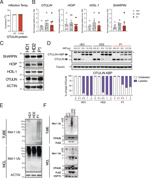 C129S OTULIN mutant protein associates with increased M1-Ub and cell death in patient cells. (A) C129S OTULIN protein thermostability is comparable to WT OTULIN protein, as assessed by Tycho. (B) Transcription of OTULIN, SHARPIN, HOIL-1, and HOIP in HD1, HD2, and patient fibroblasts was assessed by qPCR. (C) Protein levels of OTULIN, SHARPIN, HOIL-1, HOIP, and actin were assessed in HDs (HD1, HD2) and patient fibroblasts by immunoblot. (D) Fibroblast lysates from HD1, HD2, and patient lines were treated with the OTULIN ABP at stated concentrations to assess OTULIN activity. OTULIN and Tubulin (loading control) were assessed by immunoblot. Arrows indicate unlabeled (OTULIN) and labeled (OTULIN+ABP) OTULIN. * indicates non-specific band. Densitometry analysis of labeled and unlabeled OTULIN bands was performed and graphed as a percentage of total signal. (E and F) TUBE reagent was used to pull-down polyubiquitin in cell lysates. Linear Ub chains (M1-Ub) were then specifically probed for in TUBE pull-down and WCL samples. Equal loading was confirmed by blotting for actin in the WCL. This was performed in (E) lysates from HD1, HD2, and P1 fibroblasts and in (F) lysates from HEK 293T cells transiently transfected with EV, WT, C129S, or Y244C OTULIN. (A and B) Data were pooled from at least three experiments, where each dot is representative of a single experimental result and statistical significance was assessed by unpaired t test, means ± SEMs. (C–F) Data representative of at least three experiments; indicated molecular weight values in kilodaltons (kD). Source data are available for this figure: SourceData F2.