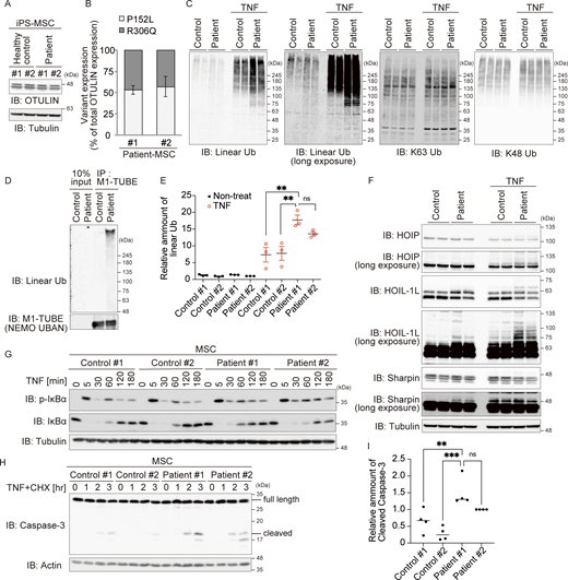 Patient-derived cells show impaired protection against cell death. (A) The amount of OTULIN in MSCs differentiated from healthy control or patient iPS cells. (B) The ratio of p.P152L to p.R306Q variant proteins in the patient’s MSCs was evaluated by MS/MS analysis. Isotope-labeled OTULIN variant proteins (as shown in Fig. S3 C) were added to lysates as an evaluation control. Bars represent the mean ± SEM (n = 3). (C and E) Immunoblot (IB) analysis of specific ubiquitin chains in MSCs treated (or not) with TNF (10 ng/ml) for 10 min. Data are representative of three independent experiments. Quantification and statistical analysis of the amount of linear ubiquitin detected in C is shown in E. Statistical significance was assessed by one-way ANOVA. ns (not significant; P > 0.05), or **P < 0.01. (D) Purification of linear ubiquitin from unstimulated MSC lysates using M1-TUBE (Halo-NEMO-UBAN). (F) Immunoblot analysis of LUBAC components in MSCs treated (or not) with TNF (10 ng/ml) for 10 min. Data are representative of three independent experiments. (G) Immunoblot analysis of IκBα phosphorylation and degradation in MSCs treated with TNF (10 ng/ml) for the indicated times. Data are representative of three independent experiments. (H and I) Activated caspase proteins in MSCs stimulated with TNF (10 ng/ml) and CHX (20 µg/ml). Densitometry analysis of cleaved caspase-3 at 3 h after stimulation with TNF+CHX (I). Data are representative of three independent experiments and expressed as the mean ± SEM. Statistical significance was assessed by one-way ANOVA. ns (not significant; P > 0.05), **P < 0.01, or ***P < 0.001. Source data are available for this figure: SourceData F5.