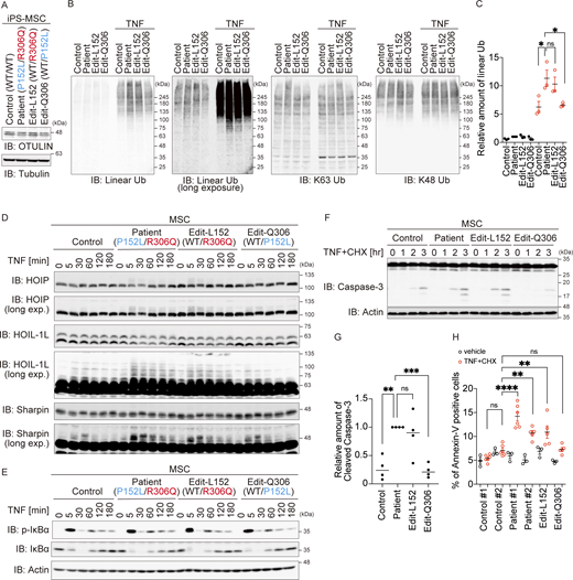 Only the de novo p.R306Q heterozygous variant in the patient augments TNF-dependent cell death. (A) Amount of OTULIN in MSCs differentiated from healthy controls, patient-derived iPS, and base-edited L152 or Q306 cells. Data are representative of three independent experiments. (B and C) Immunoblot (IB) analysis of specific ubiquitin chains in MSCs treated (or not) with TNF (10 ng/ml) for 10 min. Data are representative of three independent experiments. Quantification and statistical analysis of the amount of linear ubiquitin detected in B was shown in C. Statistical significance was assessed by one-way ANOVA. ns (not significant), or *P < 0.05. (D and E) Immunoblot analysis of LUBAC components (D), and of IκBα phosphorylation and degradation (E), in MSCs treated with TNF (10 ng/ml) for the indicated times. Data are representative of three independent experiments. (F and G) Activated caspase proteins in MSCs in response to stimulation with TNF (10 ng/ml) and CHX (20 µg/ml). Densitometry analysis of cleaved caspase-3 was performed at 3 h after stimulation with TNF+CHX (G). Data are representative of three independent experiments and are expressed as the mean ± SEM. (H) Flow cytometry analysis of Annexin-V–positive cells. MSCs were treated (or not) with TNF and CHX for 8 h. Four or six independent experiments, without or with TNF+CHX, respectively. Data are expressed as the mean ± SEM. (G and H) Statistical significance was assessed by one-way ANOVA. ns (not significant; P > 0.05), **P < 0.01, ***P < 0.001, or ****P < 0.0001. Source data are available for this figure: SourceData F6.