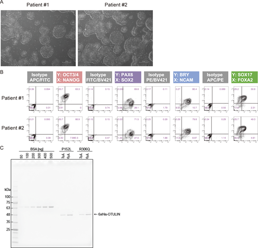 Analysis of patient-derived iPS cells. (A) Representative images of patient-derived iPS colonies. All images were captured at 4× magnification. Scale bars: 500 µm. (B) Flow cytometry analysis of the in vitro differentiation capacity of patient-derived lines. (C) Isotope-labeled recombinant OTULIN mutants. The His-tag purified proteins were visualized, along with a BSA standard, by CBB staining of SDS-PAGE gels. Source data are available for this figure: SourceData FS3.