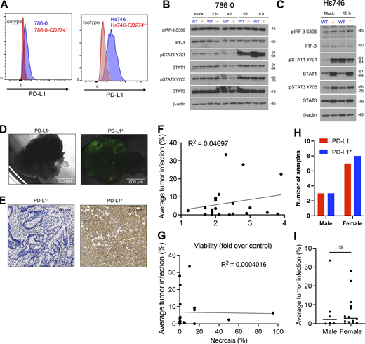 PD-L1 alters type I IFN responses in human cancer cells. (A) 786-0 (left) and Hs746 (right) cells were electroporated with Cas9 and gRNA targeting PD-L1 to generate CD274−/− cells. Representative plots depicting PD-L1 expression are shown. (B) 786-0 and 786-0-CD274−/− cells infected with VSVΔ51-YFP at MOI 1 (or mock-infected) and analyzed by western blotting at indicated times after infection. Images depicted are representative of three with similar results. (C) Hs746 and Hs746-CD274−/− cells infected with VSVΔ51-YFP at MOI 0.1 (or mock-infected) for 16 h prior to western blotting analysis. Images depicted are representative of three with similar results. (D) Fluorescent imaging of tumor explant cores from patient biopsies infected with VSVΔ51-YFP for 48 h prior to imaging for viral YFP reporter. Images of poorly infected (left) and well-infected (right) tumors are depicted. Scale bar = 600 μm. (E) Patient tumor biopsies subjected to PD-L1 IHC to determine PD-L1 status of tumors. Images of PD-L1− (left) and PD-L1+ (right) tumors are depicted. Scale bar = 100 μm. (F and G) Average tumor infection plotted against viability (assessed by Alamar Blue) and necrosis (% of tumor section necrotic, assessed by histology). (H and I) Distribution of PD-L1+ and PD-L1− tumors and average tumor infection between male and female donors. Statistical analysis by two-tailed unpaired Student’s t test. P > 0.05 not significant (ns). Source data are available for this figure: SourceData FS5.