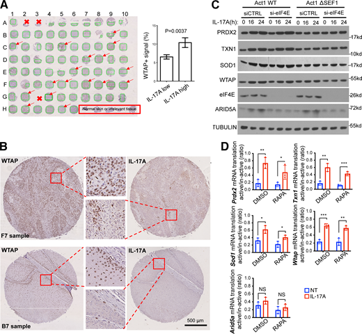 IL-17 enhances cap-independent translation of WTAP and antioxidants, consistent with elevated IL-17A-WTAP axis in human skin tumor tissues. (A) Green boxes indicate the stained WTAP areas that were subjected to ImageJ analysis. Arrows indicate the samples that belong to IL-17A high group. Bar graph comparing the quantification of WTAP staining in IL-17A-low and IL-17A-high groups. P = 0.0037 by t test. ±SEM. (B) Images of WTAP staining and IL-17A staining from two samples (IL-17A high: F7; IL-17A low: B7, as shown in panel A). Scale bar, 500 μm. (C) WT Act1 or Act1 ΔSEF1 MEFs transfected with siCTRL or si-eIF4E were treated with IL-17A. The cell lysates were subjected to western blot analysis. (D) MOC1 cells pretreated with rapamycin were either left untreated or treated with IL-17A, followed by fractionation. Indicated mRNAs from translation-active pools and translation-inactive pools were analyzed by RT-PCR and normalized to β-actin. Graph shows the ratios of mRNAs from translation-active/inactive pools (n = 3 independent plates of cells). Two-tailed t test was performed. *P < 0.05, **P < 0.01, and ***P < 0.001; NS, not significant. Source data are available for this figure: SourceData FS2. Refer to the image caption for details.