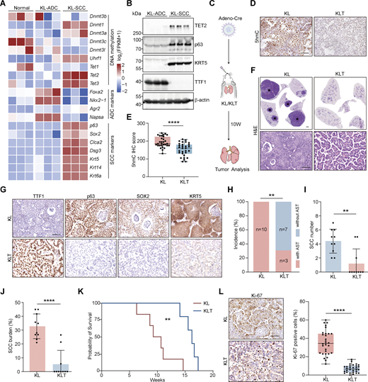 Tet2 KO inhibits squamous transition in KL model. (A) Heatmap of DNA methylation factors and adeno/squamous lineage markers in normal lung, ADC, and SCC of the KL mouse model. (B) Western blot analysis for TET2, p63, KRT5, and TTF1 in KL-ADC and KL-SCC tumors. β-Actin served as the internal loading control. Parallel blots using the same samples. (C) Schematic illustration of the KL and KLT mouse model. W, week. (D and E) (D) Representative 5hmC IHC staining of KL and KLT tumors. Scale bar: 50 μm. Statistical analysis is also shown (E). 30 representative images for each group were counted. (F) Representative H&E staining for whole lungs of KL and KLT models. The whole lungs are reused in Fig. S2 E. * indicates SCC. Scale bar: 1 mm. H&E staining with high magnification is shown. Scale bar: 50 μm. (G) Representative IHC staining for TTF1, p63, SOX2, and KRT5 in KL and KLT mice. Scale bar: 50 μm. (H–J) Statistical analyses of the AST incidence (H), the number (I), and burden (J) of SCC in KL (n = 10) and KLT (n = 10) mice. (K) Kaplan–Meier survival curves of KL (n = 6) and KLT (n = 5) mice. (L) Representative Ki-67 IHC staining and statistical analyses in KL and KLT tumors. Scale bar: 50 μm. 30 representative images for each group were counted. Data in B, D, and E represent one experiment of three independent repeats, and F–L represents one experiment of two independent repeats. **P < 0.01, ****P < 0.0001 by two-tailed unpaired Student’s t test (E, I, J, and L), Fisher’s exact test (H), log-rank (Mantel–Cox) test (K). Data are represented as mean ± SD. Source data are available for this figure: SourceData F1. Refer to the image caption for details.